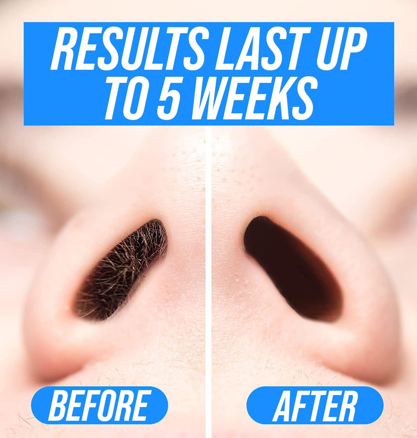 Kenashii Super Nose Wax Kit | 100 G Wax, 24 Applicators | No Microwave Required | New Nose and Ear Hair Removal Kit | Nasal Waxing for Men and Women | 12 X Balm Wipes and Mustache Guards | Storage Bag image number 4