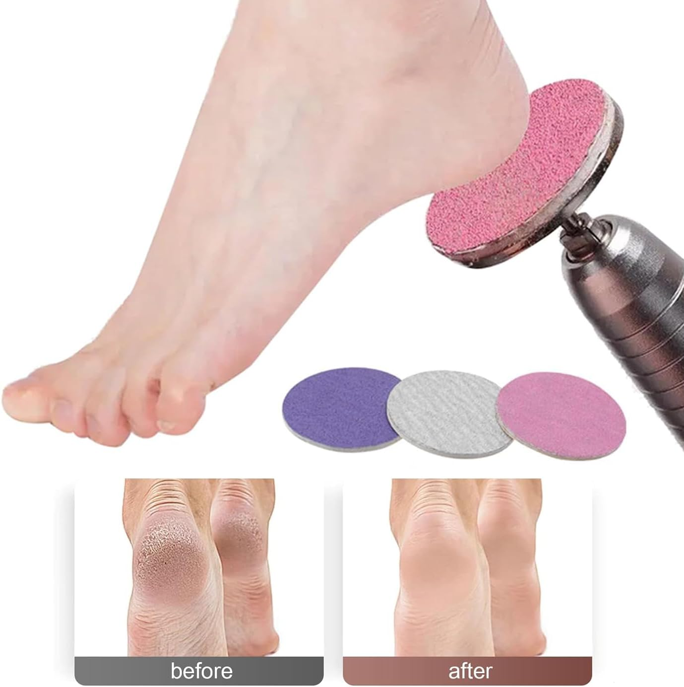 Mesee 60Pcs Sanding Paper Discs for Pedicure 25Mm Foot Grinder Sandpaper Replacement Self-Adhesive Foot File Sandpaper Disk Pad with Metal Nail Drill Bit for Manicure Pedicure Dead Skin Callus Removal image number 3