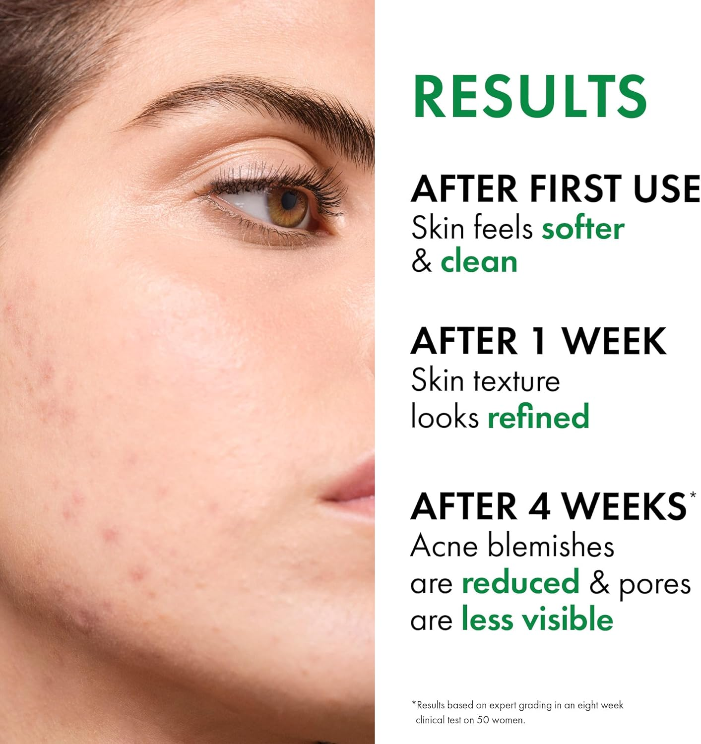 Vichy Normaderm Phytosolution Double-Correction Daily Care 50Ml image number 2