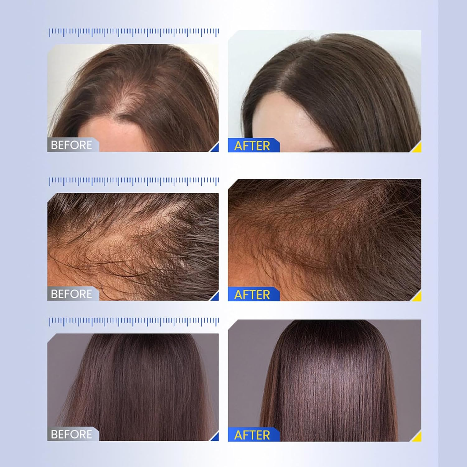 Hair Growth Serum with Roller Applicator - 30Ml Scalp Treatment for Thinning Hair - Strengthening & Nourishing Hair Care Essence for Men & Women image number 3