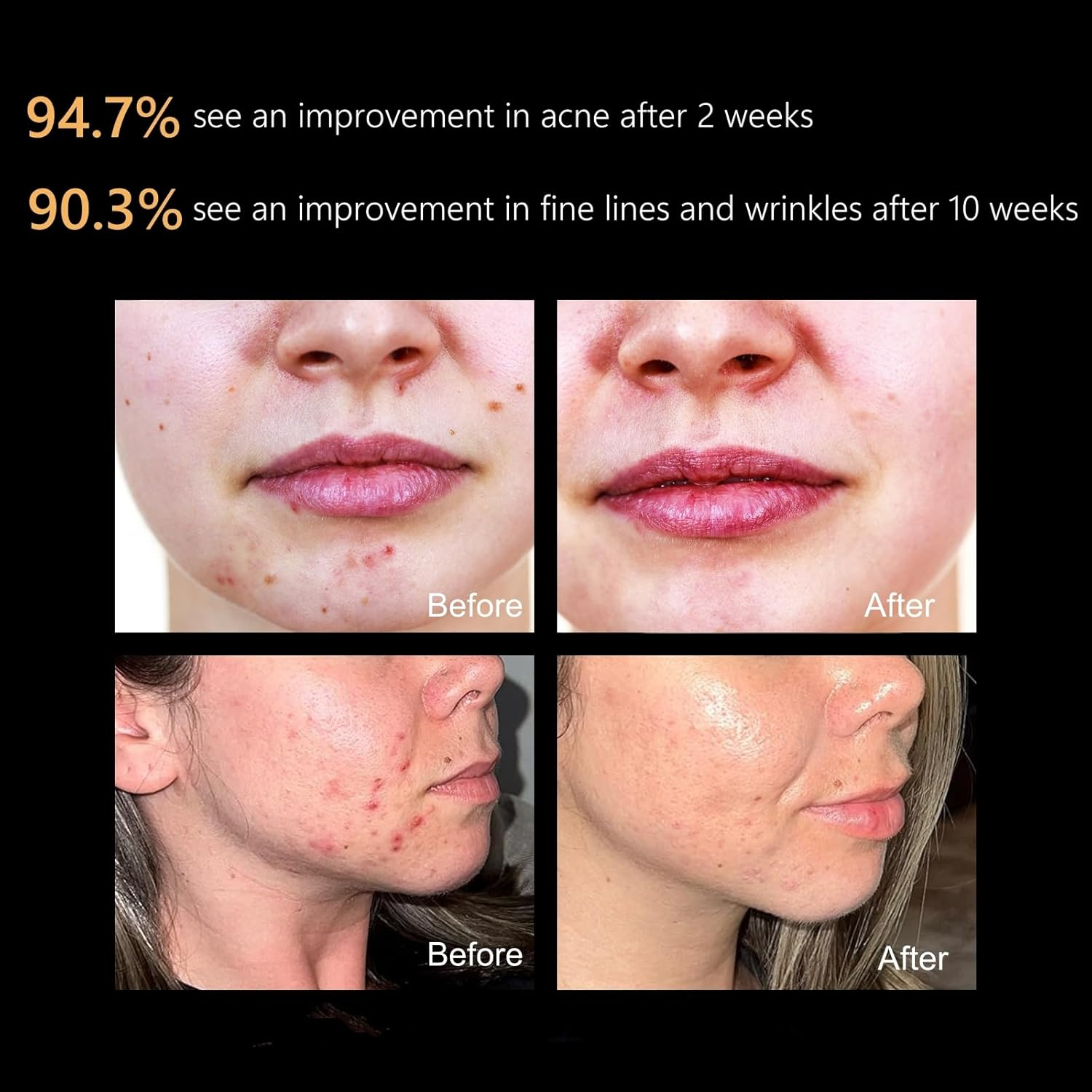 Aphrona FDA Cleared LED Facial Skin Care Mask MOONLIGHT PRO 7 Color Treatment Photon Mask (White) image number 1