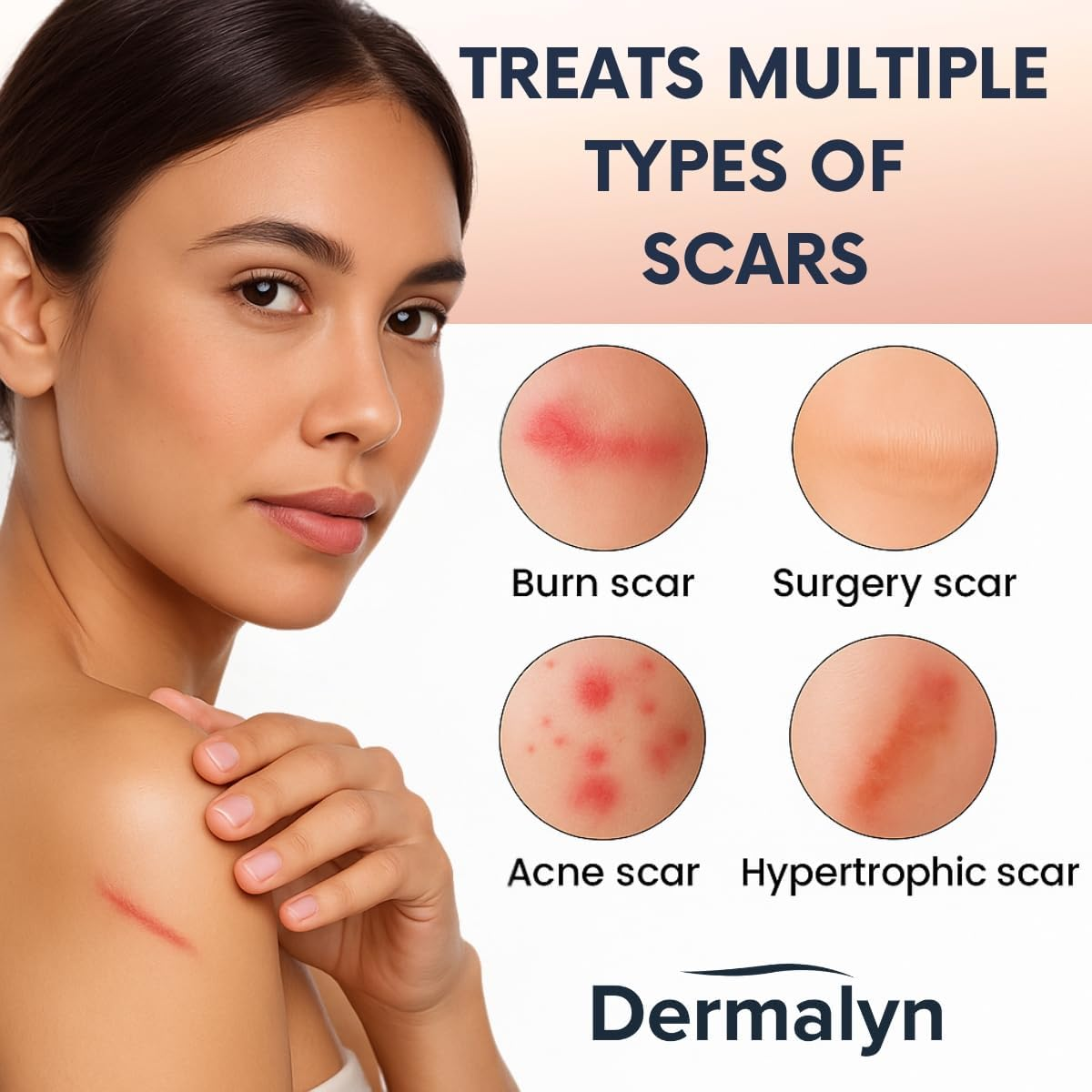 Dermalyn Silicone Scar Tape Roll (4Cm X 1.5M), Reusable Medical-Grade Silicone Scar Sheets for Surgery, C-Section, Burn, Keloid & Acne Scars