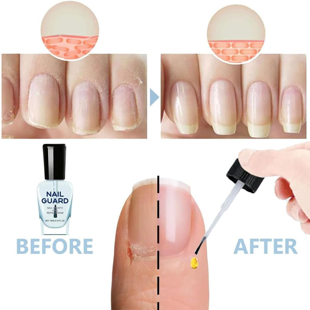 Onyxoguard Nail Growth and Repair Serum,Natural Formula Nail Serum Nail Growth Oil,Nail Growth and Repair Serum (2Pcs) image number 5