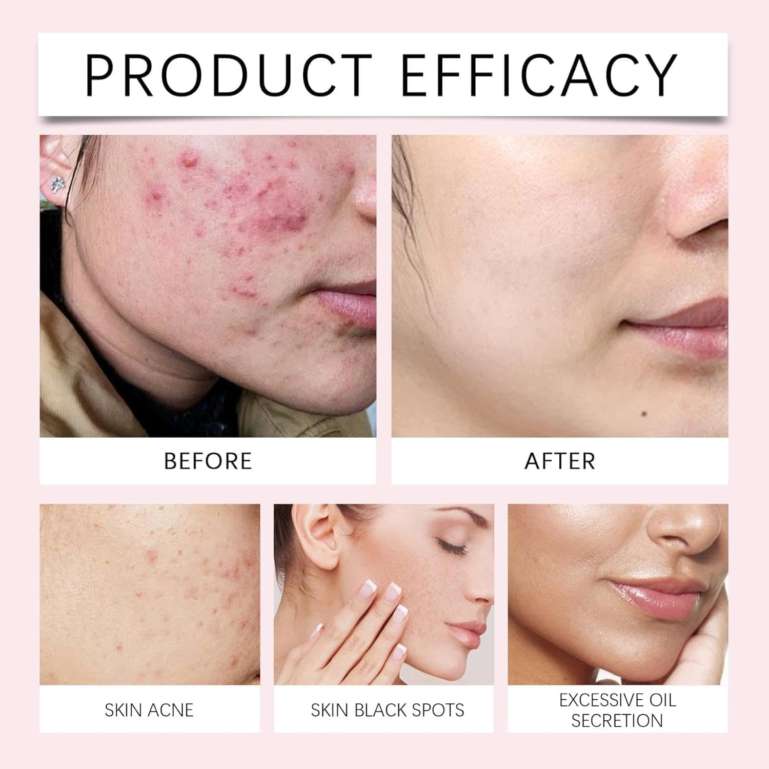 40 Pcs Kojic Acid and Turmeric Cleansing Pads,Turmeric Cleansing Pads for Dark Spots and Exfoliating, Reduce Blemishes & Dark Area,Deep Cleansing Oil Control Shrink Pore Mild Formula, for All Skin Types,100% Natural image number 5