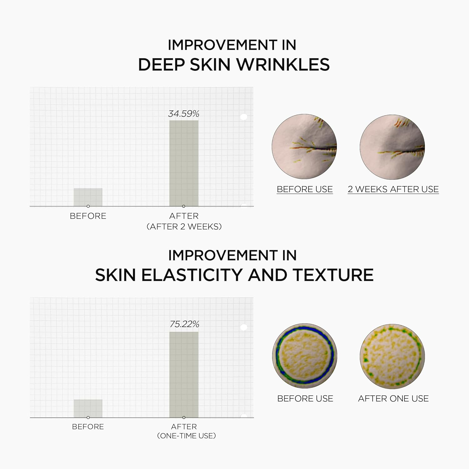 SKIN1004 Retinol 0.2% Boosting Shot Ampoule, 30Ml, Hydrating Retinol Serum for Face, Concentrated Korean Facial Spicule Serum with Retinol & Retinal, Skin Barrier Repair & Balance, Madagascar Centella, Korean Skincare image number 1