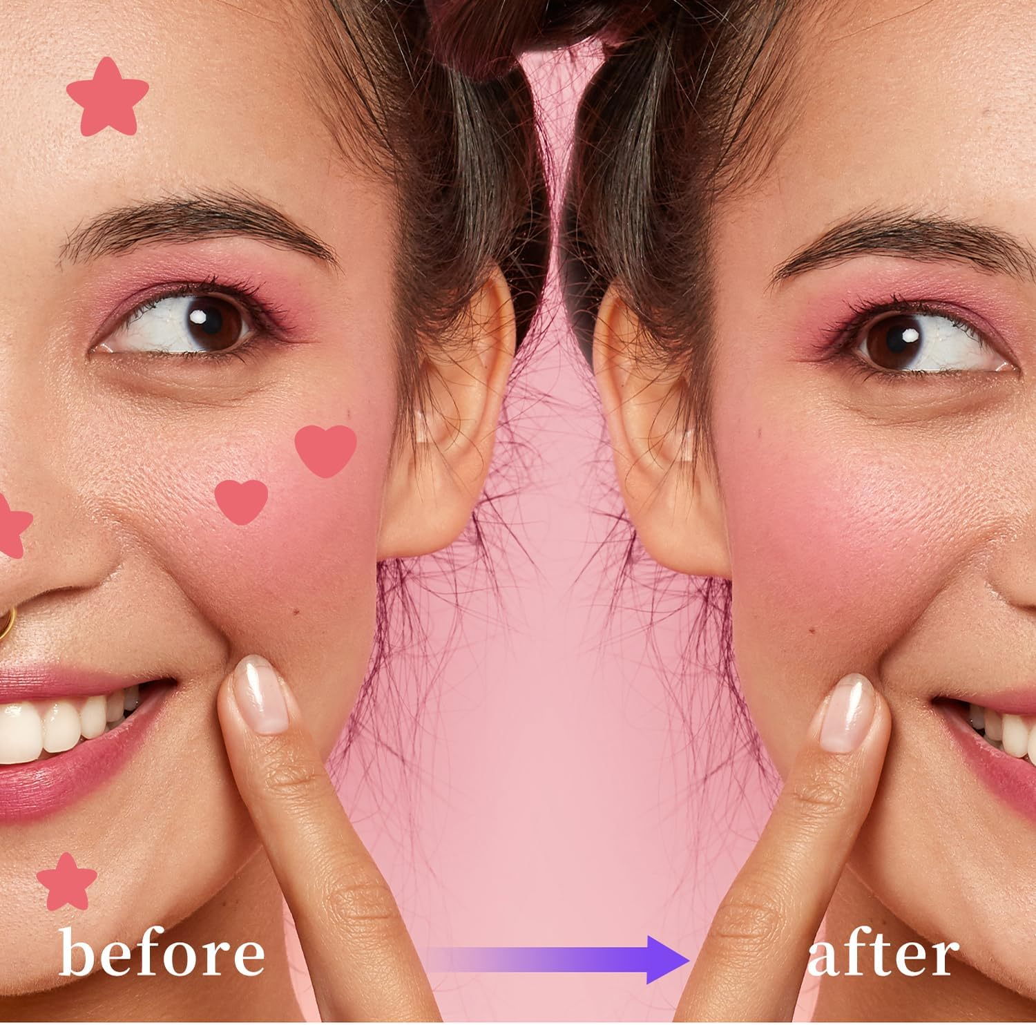 Acne Patches, 72 Pack with Multiple Sizes, Star and Heart Shapes, 6-8 Hour Treatment image number 5