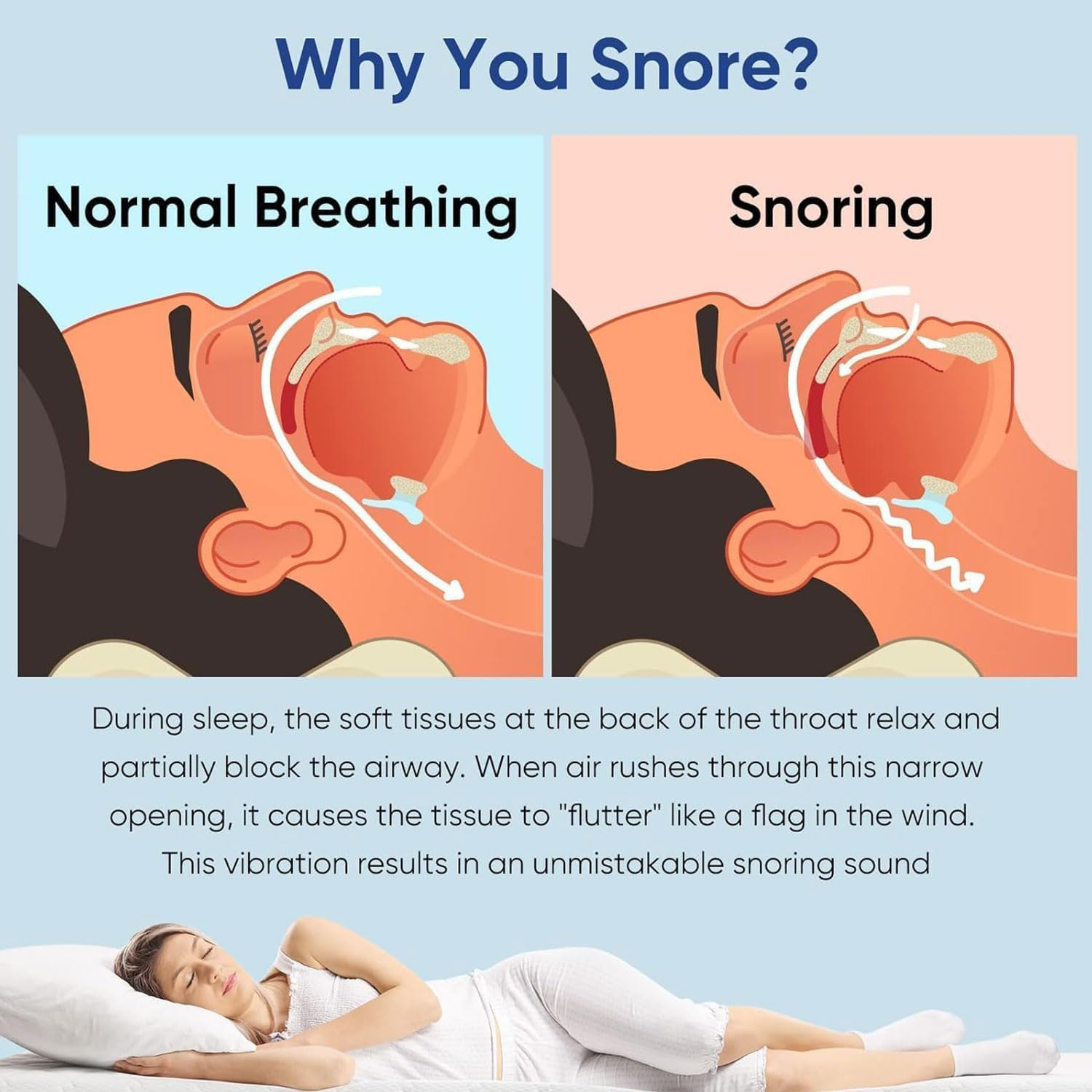 Reusable anti Snoring Devices, Mouth Guard for Teeth Grinding for All Mouth Shapes, Sleeping Aid anti Snore Mouthguard, Bpa-Free, Ready to Use Snoring Stopper for Your Partner image number 4