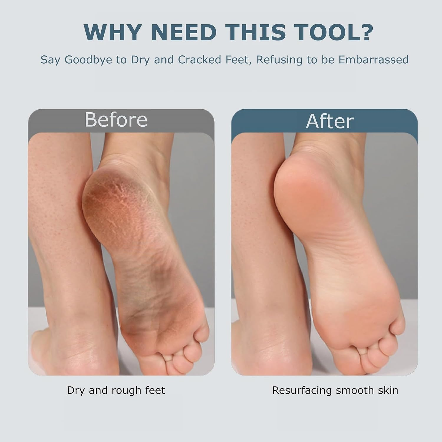 Rechargeable Portable Electronic Foot File Pedicure Kits，Electric Foot Callus Remover, Waterproof Electric Foot Scrubber File, Professional Pedi Feet Care Pedicure Tools, Foot Care for Dead Skin image number 4