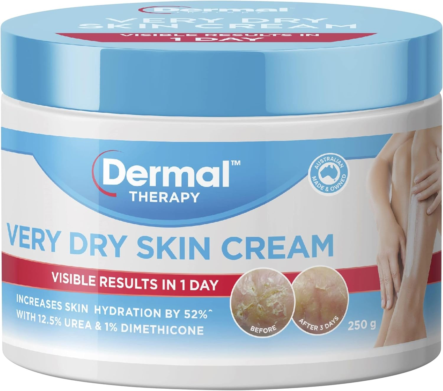 Dermal Therapy Very Dry Skin Cream for Optimum Hydration | Provides Deep Moisturisation for Severely Dry Skin on the Arms, Legs, Elbows and Back | 250G image number 4