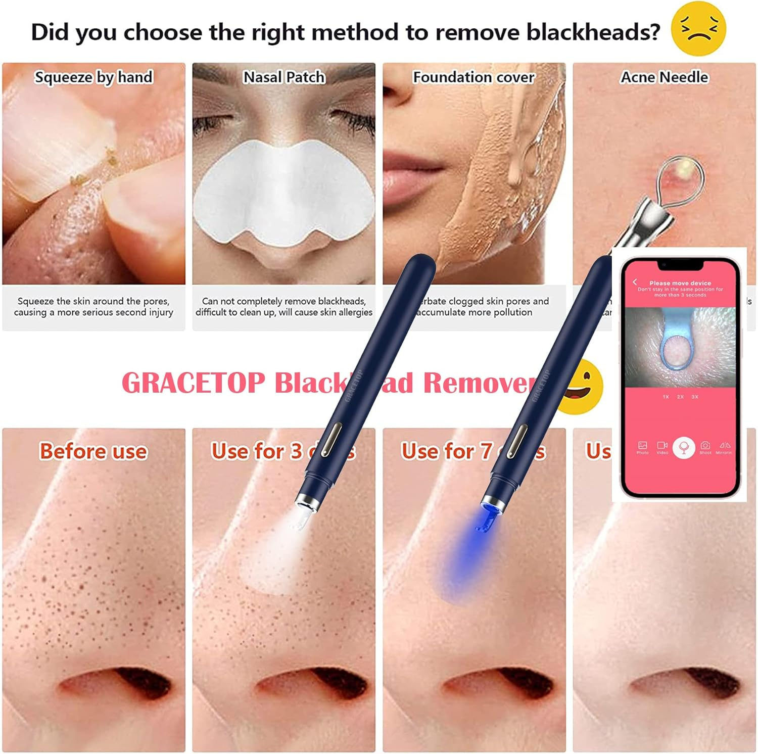Blackhead Remover Tools with Camera Visible Pore Cleaner Waterproof Acne Comedone Whitehead Extractor Kit for Iphone/Android image number 6
