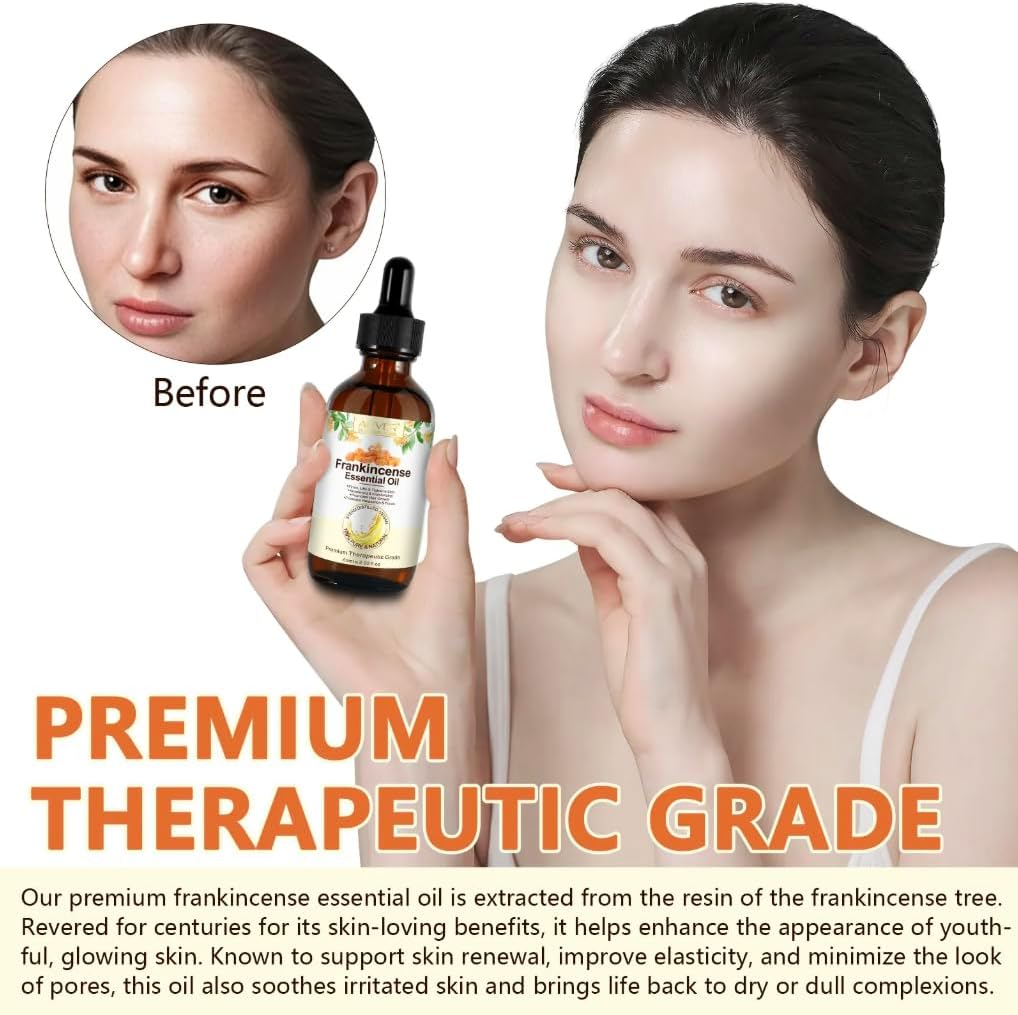 Frankincense Essential Oil 100% Pure & Natural &ndash; Therapeutic Grade, Undiluted &ndash; Aromatherapy Oil for Skin, Face, Hair, Diffuser, Massage & Relaxation &ndash; 60Ml