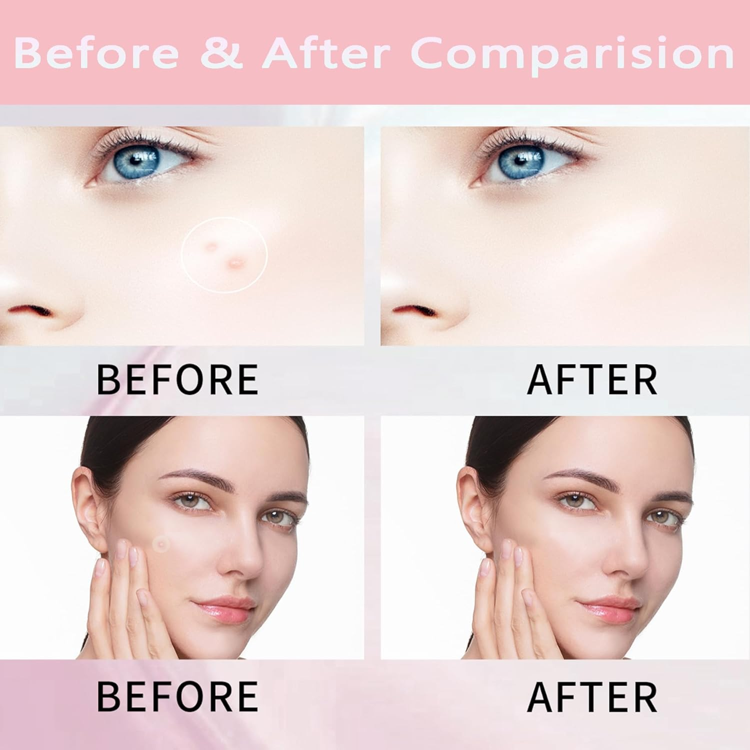 Wakouter Pimple Patches, Miracle Invisible Spot Cover, Hydrocolloid Acne for Face and Zits Absorbing Patch, for Covering Zits and Blemishes, Spot Stickers for Facial Sticker, 2 Sizes (108Count) image number 4