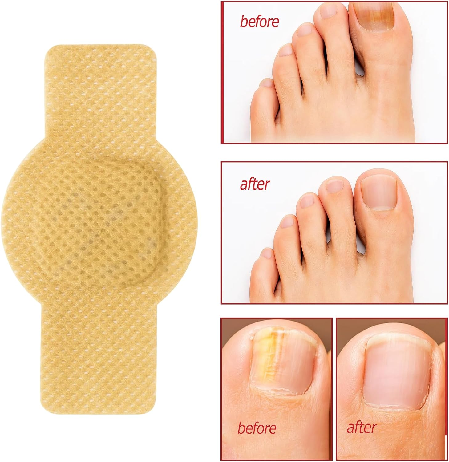 21 Pcs Fungal Nail Patches, Toe Nail Fungus Treatment, Nail Repair Patches for Damaged and Discolored Nails, Overnight Nail Care Solution for People image number 1