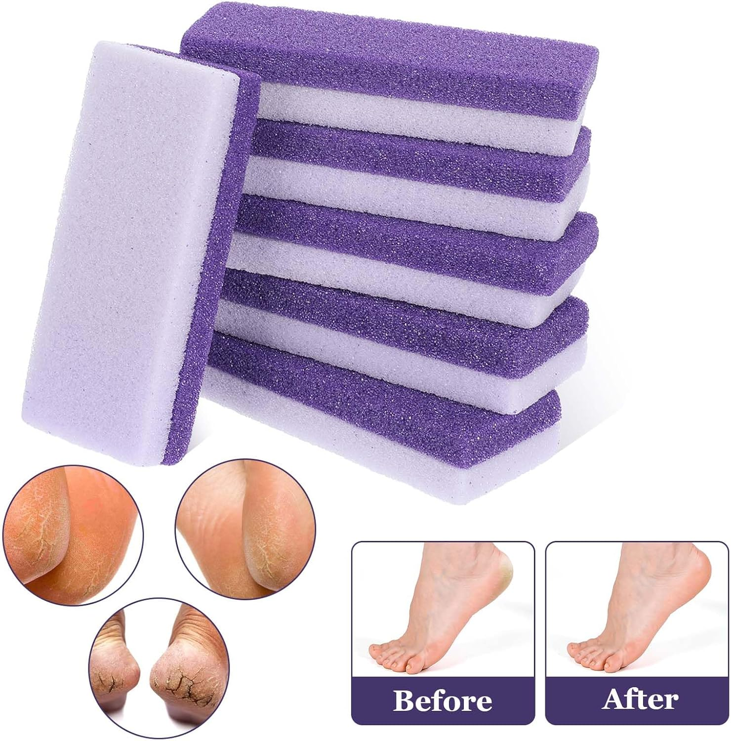 Ptwola Pack of 6 Double-Sided Foot Care Pumice Stone One Side Is a Coarse Callus Remover Foot Pumice Stones the Other Side Softens the Skin for Feet Remove Dead Callus Cuticles image number 6