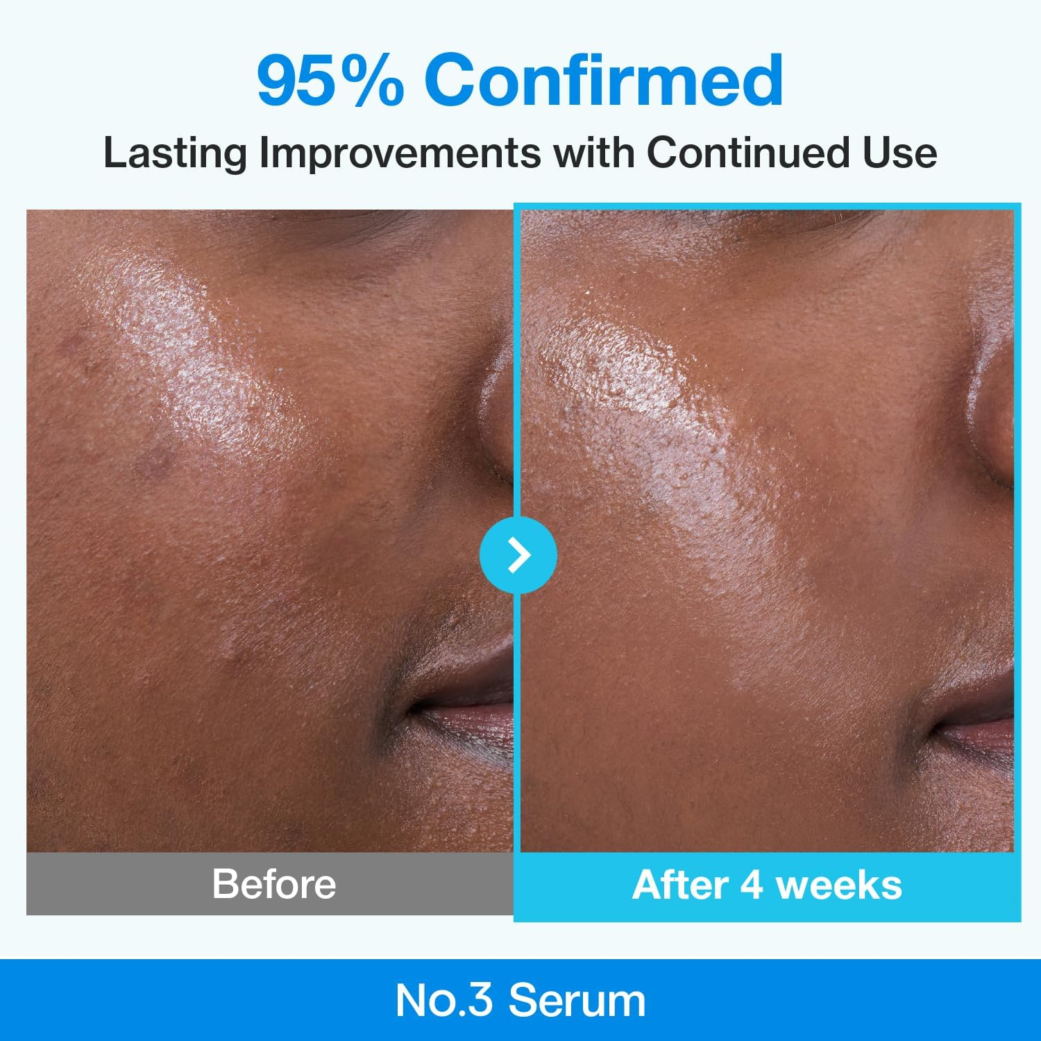 Numbuzin No.3 Serum | Blue Retinol Pore Refining Serum | Pore Tightening, Firming, Anti-Aging, Korean Skincare | Niacinamide, Peptide, Salicylic Acid (BHA) | Beginner-Friendly Retinol | 1.01 Fl.0Z image number 1