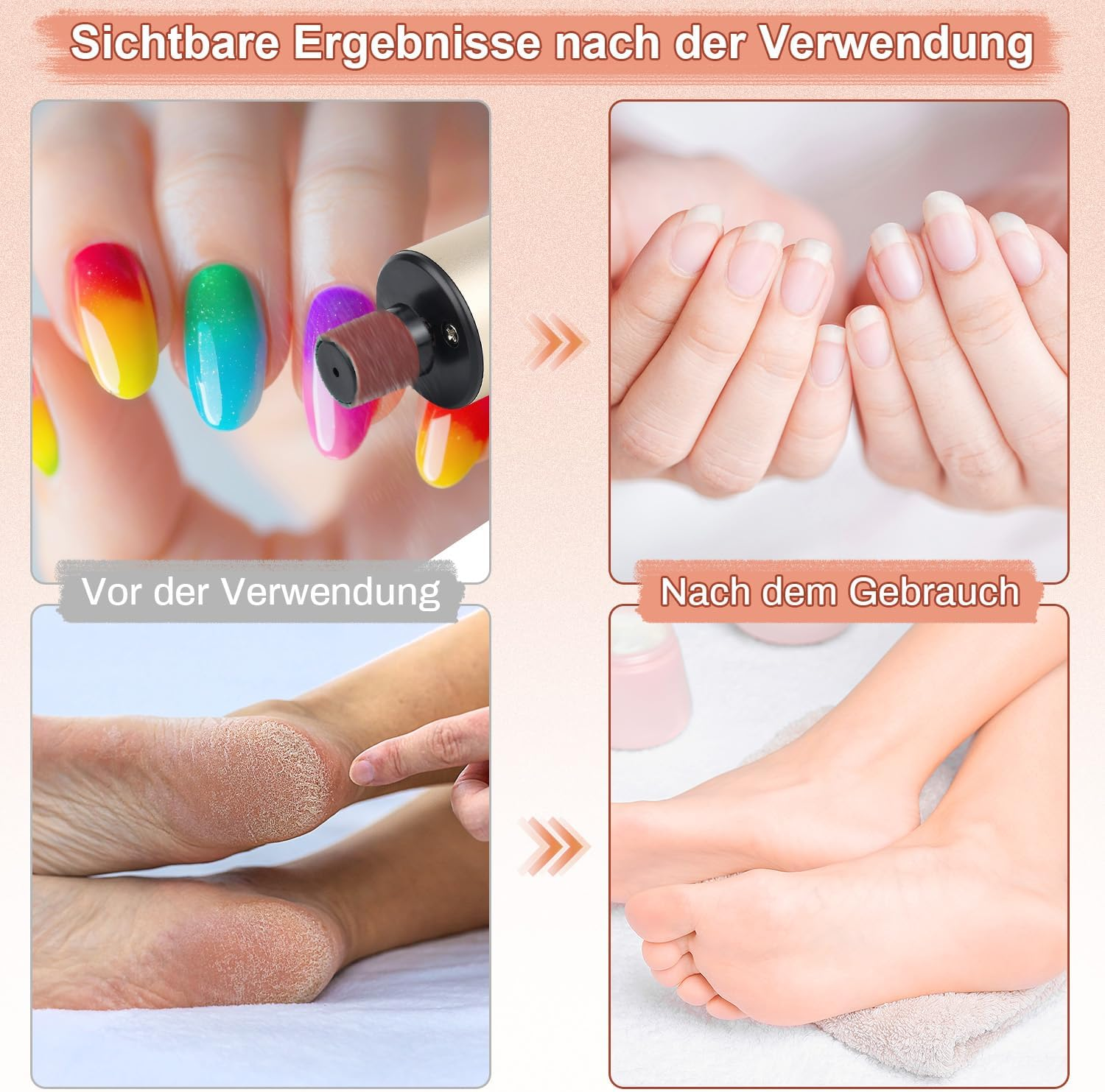 Electric Callus Remover, Electric Callus Remover, Foldable 2 in 1 with 80 & 120 Sandpaper, 9 Speeds Callus Removal, Foot Electric for Callus Removal, Cracked Heels image number 1