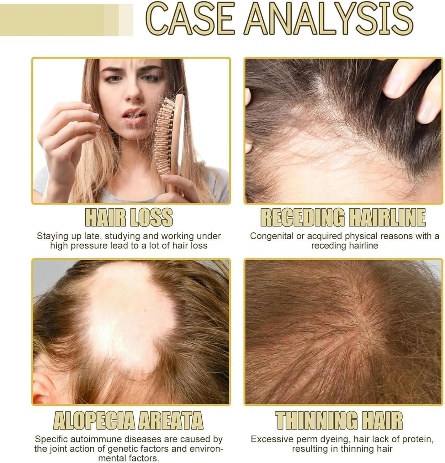 2PCS Veganic Natural Hair Growth Oil,Natural Hair Growth Oil,Natural Hair Density Essential Oil,Rosemary Hair Growth Oil for Dry Damaged Hair and Growth Thin Hair