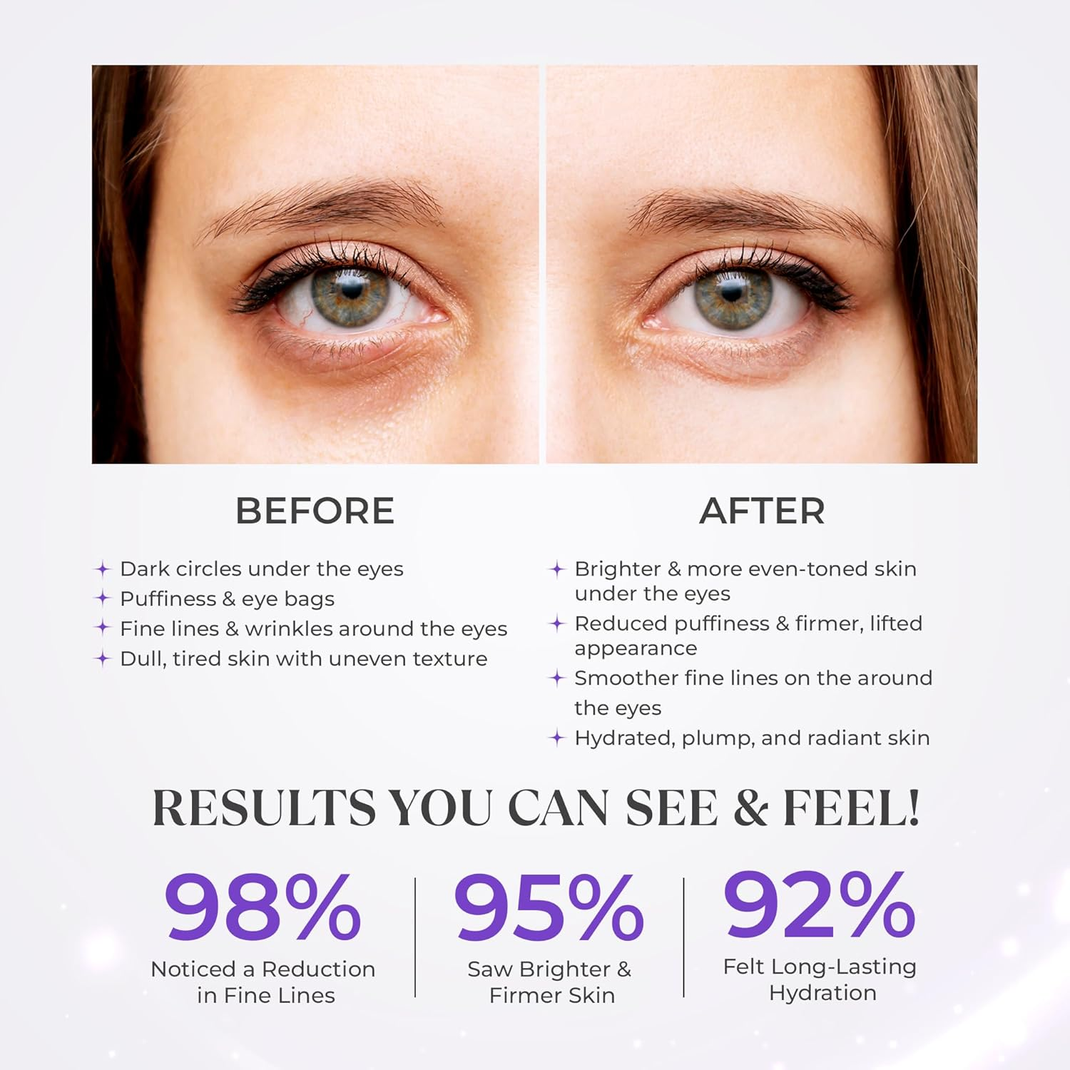 Magic Eye Revive Cream | Advanced Anti-Aging Treatment with Built in Viberating Massager | Hyderating, Firming & Brightening Formula | anti Wrinkle, Fine Lines & Dark Circles, Puffiness & under Eye Bags | Peptide Infused with Herbal Extracts image number 3