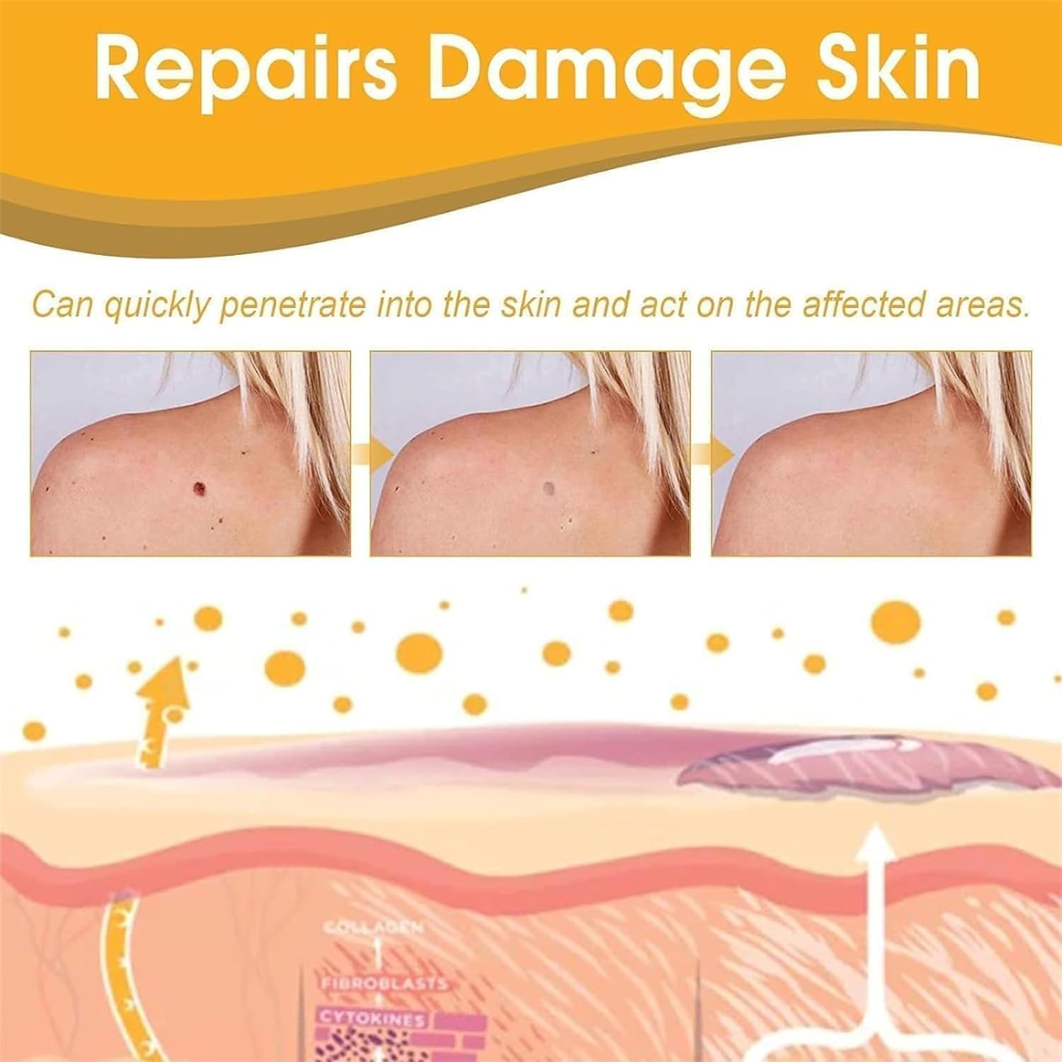 WAYAOFEI Tag Recede Bee Venom Spray,Tag Recede Bee Venom Spray for All Skin Types,20Ml/Pcs (1) image number 1