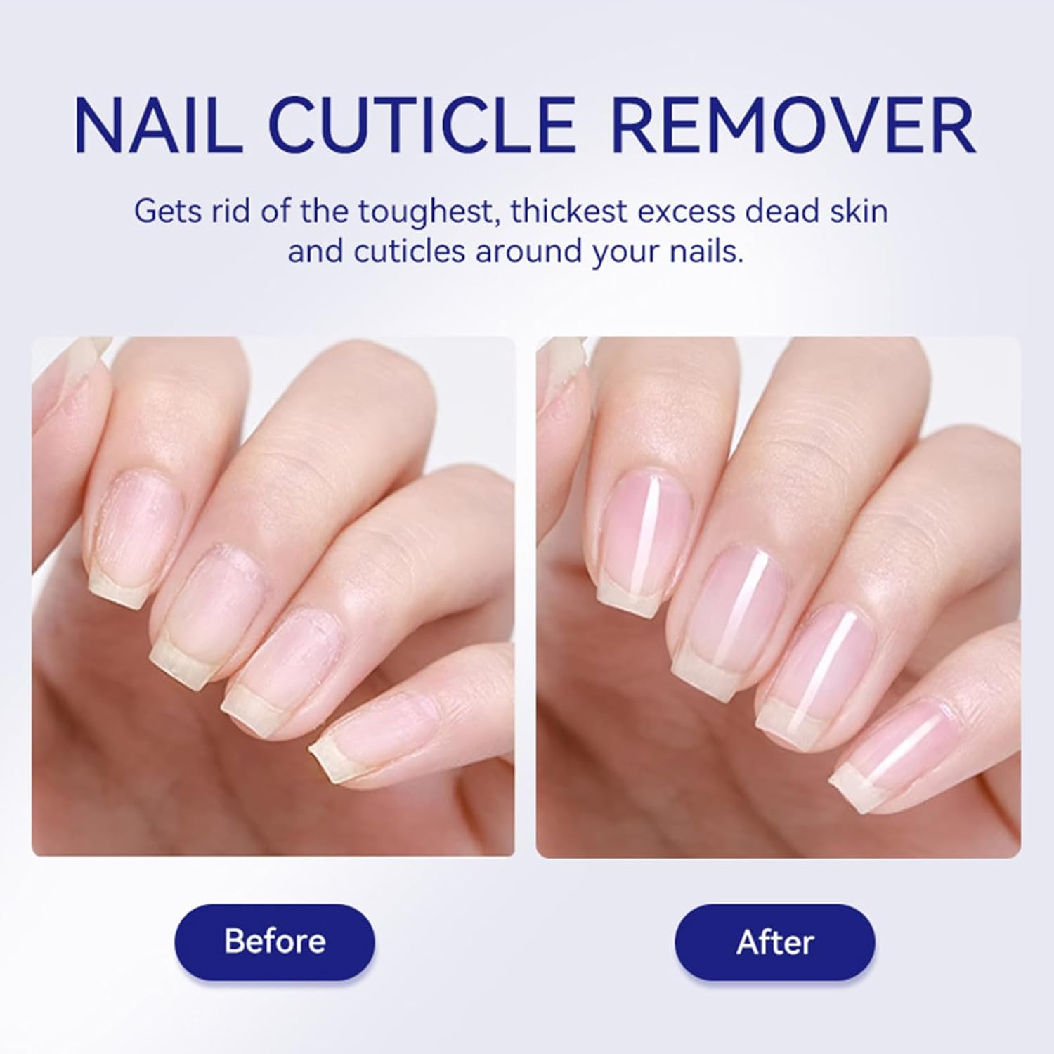 Cuticle Remover Liquid,Instant Hydrating Manicure Tools | 30Ml Moisturizing Cuticle Softener Gel - for Dead Skin Hangnails Brittle Beauty Routine Daily Salon Home Travel Foot Manicure image number 4