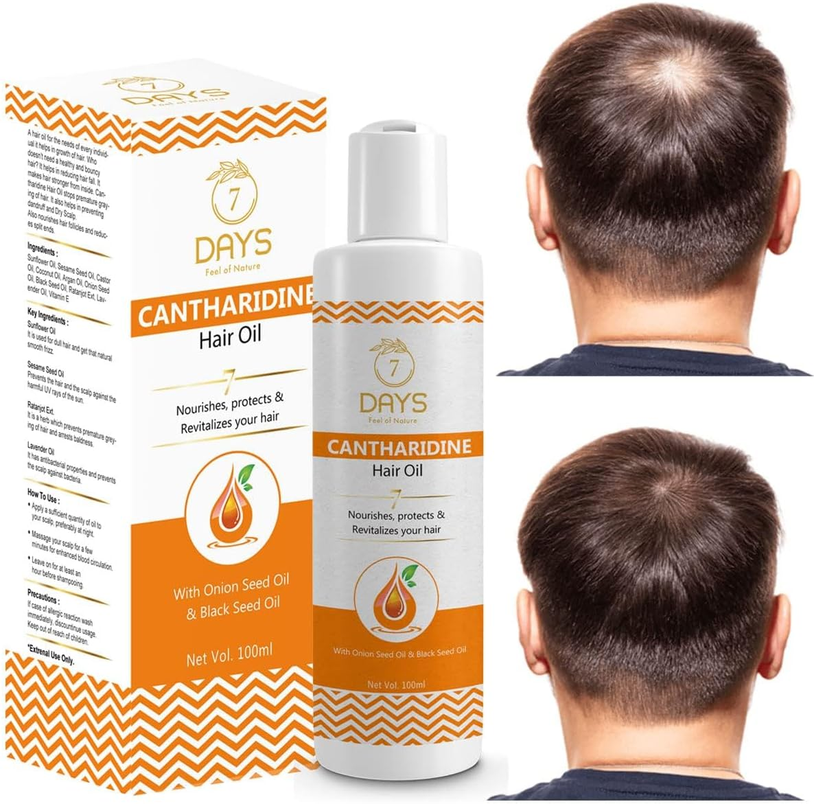 Green Velly 7 Days Cantharidine Oil for Hair | Control Hair Fall | Reduce Dandruff |Multi-Purpose Hair Growth Oil/Serum with Argan, Bhringraj, Hibiscus, Sesame,Amla,Sweet Almond, Olive (200 Ml) image number 1