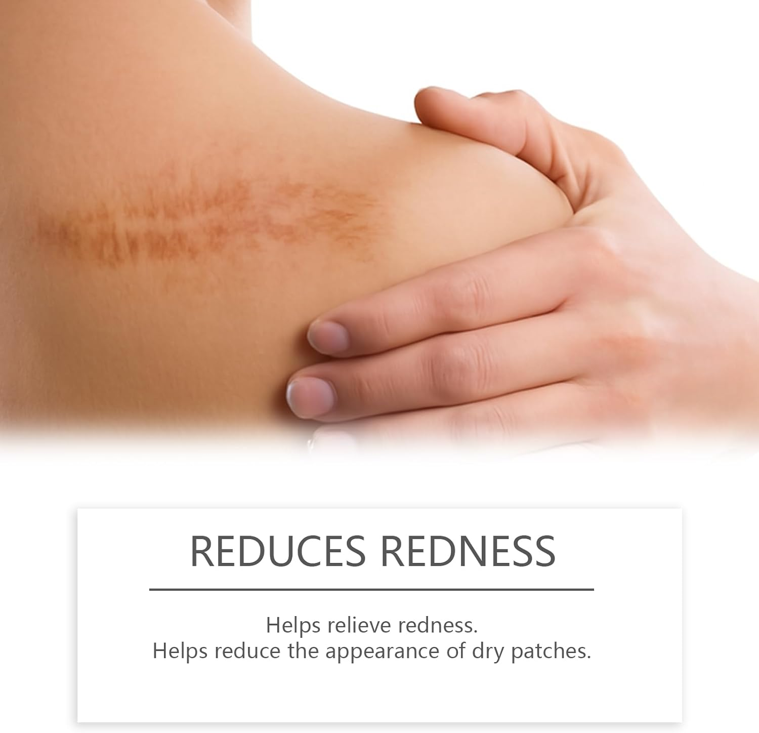 Scar Solutions Silicone Scar Stick, Lightweight & Easy to Apply, Gentle on All Skin Types image number 1