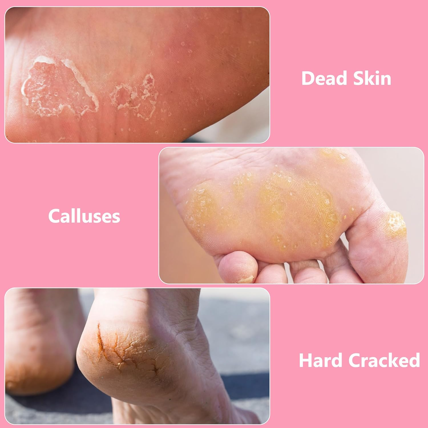 OWIIZI Foot File Pedicure Foot Scrubber for Callus Remover, Stainless Steel Foot Exfoliator Grater Feet Rasp Scraper Hard Cracked Dead Skin Removers for Wet and Dry Foot