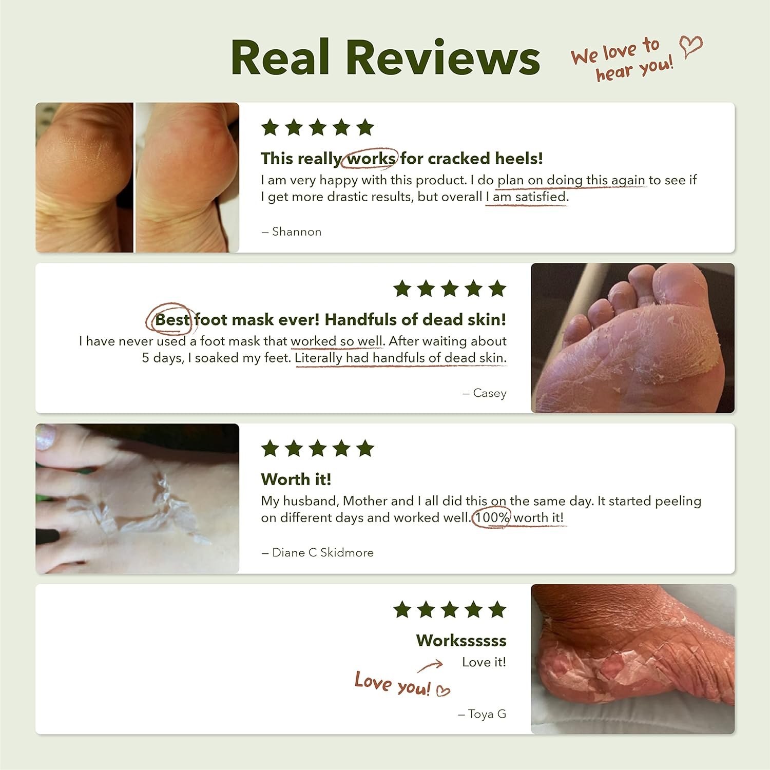 Purederm Shiny & Soft Foot Peeling Mask (6 Pack) - for Smooth and Moist Baby Skin with Exfoliating Peel off Calluses, Dry Skin, Cracked Heels - Men and Women image number 3