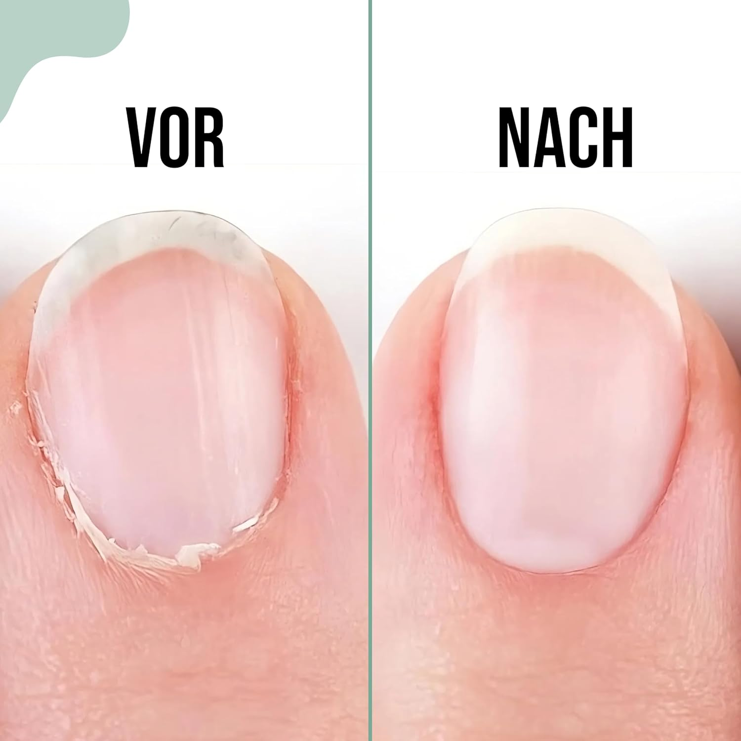 ARMIZ Multi-Color Cuticle Nipper Stainless Steel Professional Cuticle Cutter for Manicure and Pedicure - Cuticle Remover Tool with Sharp Blade to Trim Tough Dead Skin, and Hangnails image number 2