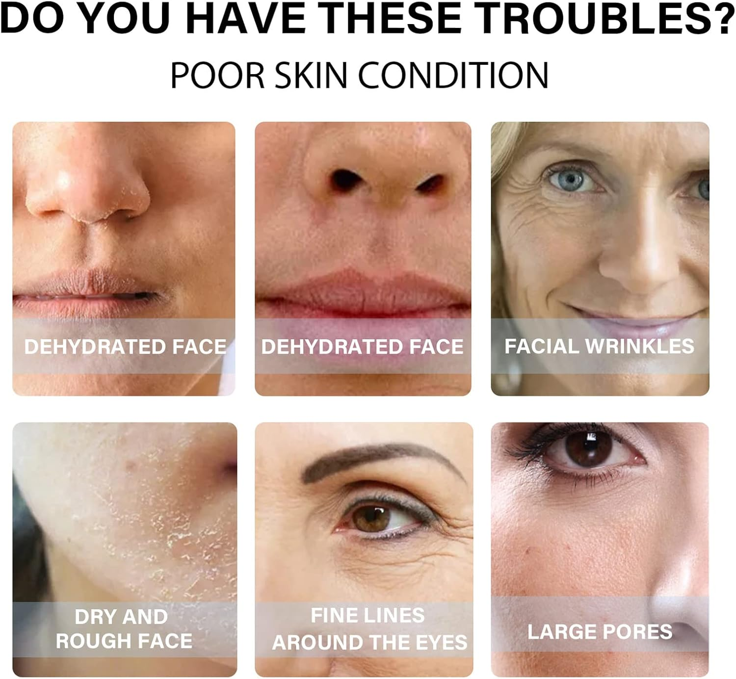 20PCS/ Bottle Protein Thread Lifting Line -Aging -Wrinkles Pore Replenish Moisturing Skin Elasticity Refining for Home Daily Salon Use ALKOY image number 1