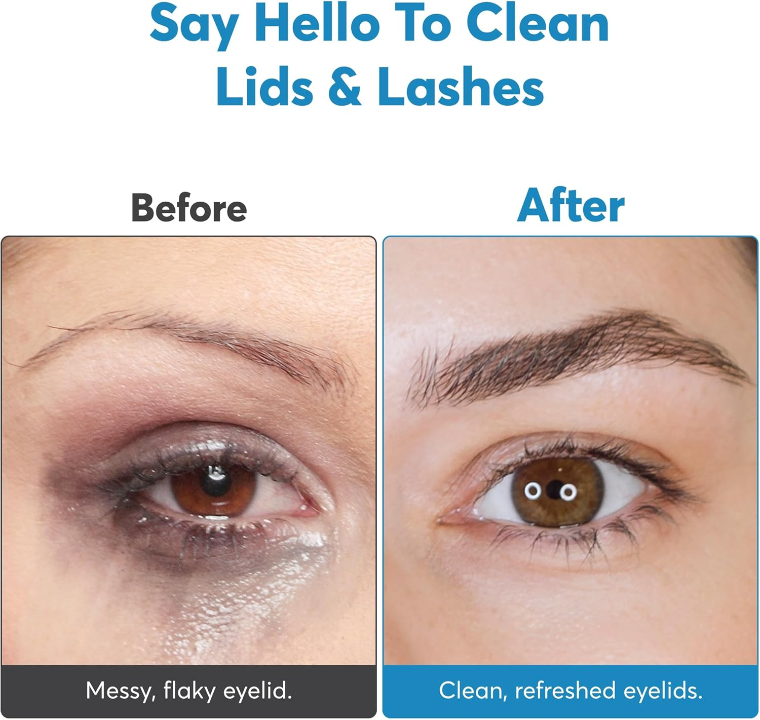 Lustrous Lids Eyelid Cleaner Made from Soft Silicone - Eyelid Margin Scrub Brush - Delicately Cleans Eyelids - Designed for Delicate Skin around the Eyes, Remove Debris and Makeup - (Pack of 2) image number 5