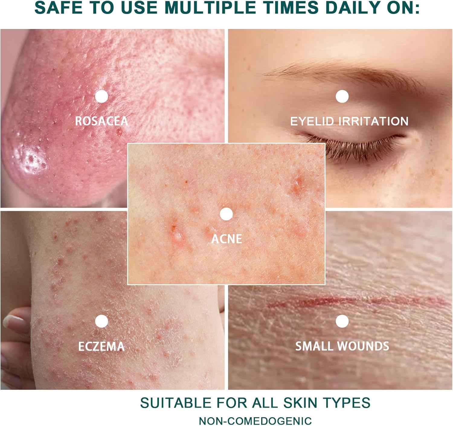 Hypochlorous Acid Face and Skin Spray,30Ml Soothing Facial Spray Face Toner, Hypochlorous Acid Spray for Red and Swollen Skin, Broken Skin Calming Emulsion for Sensitive Skin image number 5