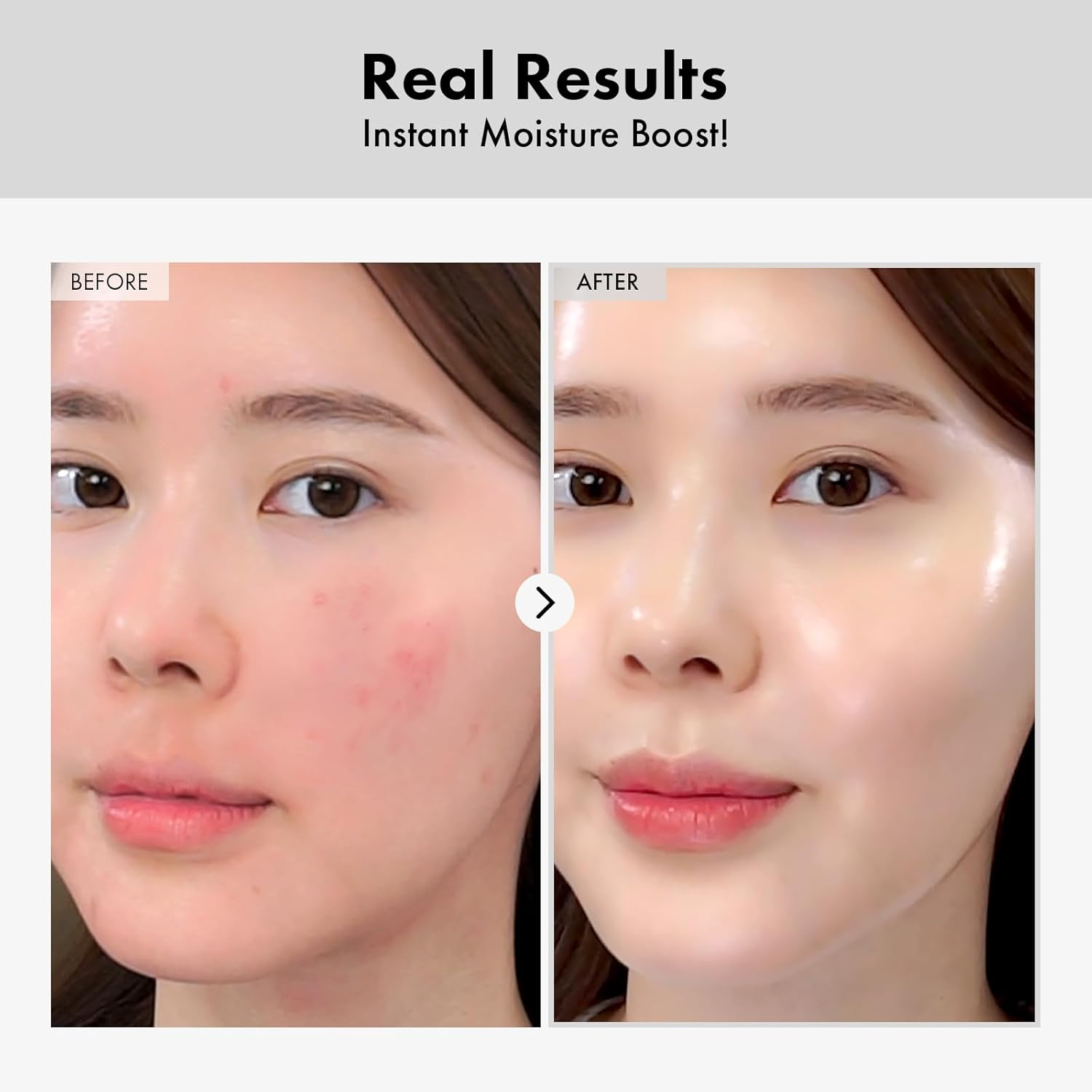 TOSOWOONG Hyaluronic Acid Ampoule, Hydrating Glow and Skin Barrier Protection, Anti-Aging Face Serum for Dry Skin, Korean Skincare Beauty Products, 100Ml, 3.38 Fl. Oz. image number 3