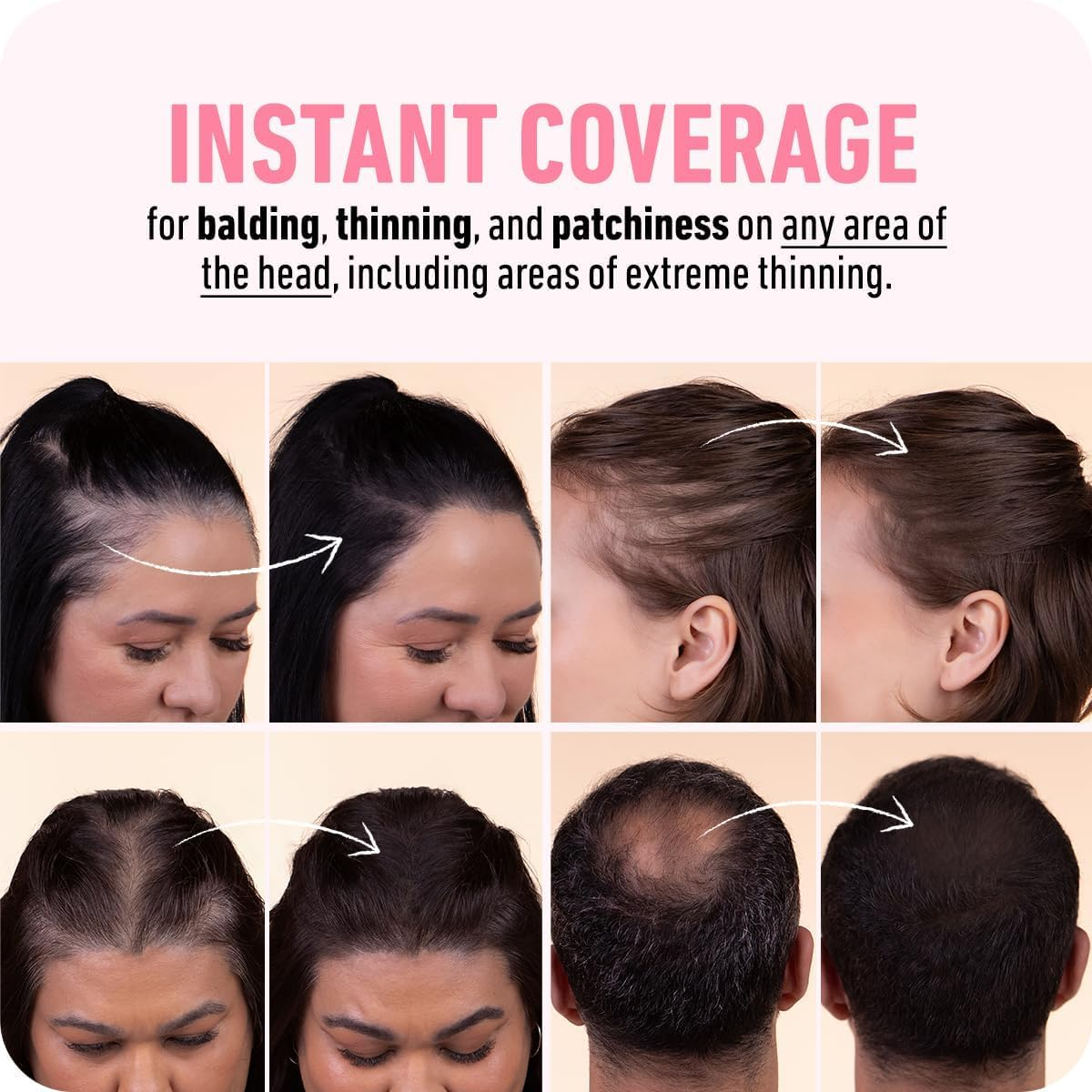 BOLDIFY Hairline Powder - Root Touch up Hair Color for Gray Coverage - Bald Spot Concealing Hair Powder for Women and Men - 24-Hour Stain-Proof (Black) image number 7