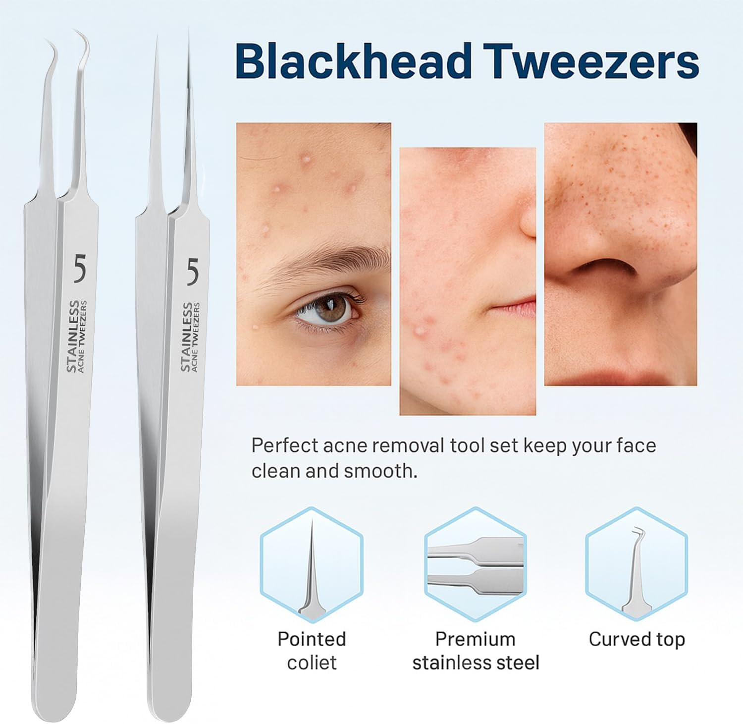 Blackhead Remover Tweezers, Pimple Popper Tool, Ingrown Hair Tweezers, Acne Removal Tool, Comedone Extractor, Precision Blackhead Extractor, Compatible with Acne, Blackheads & Pimples, Ermaoo image number 2