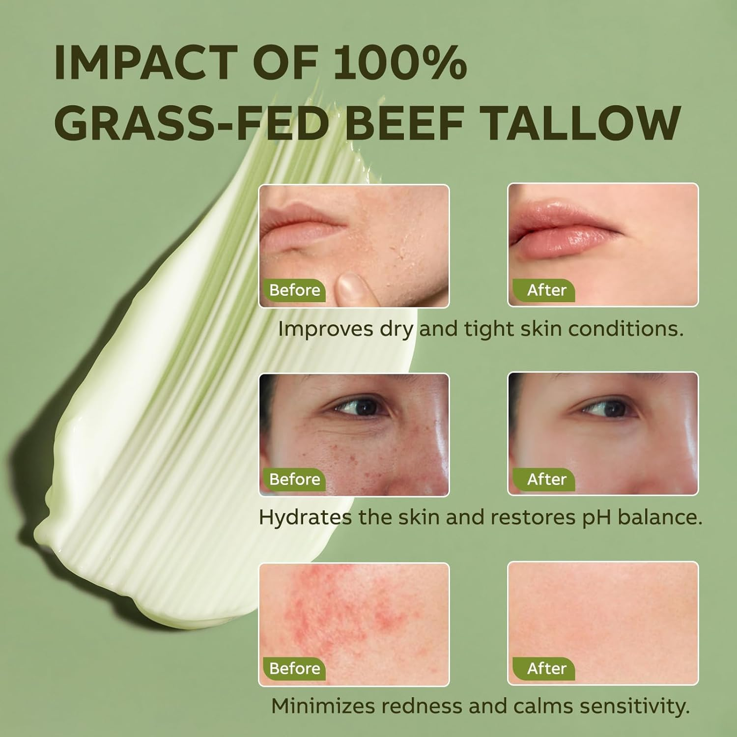 Beef Tallow Moisturiser, Tallow and Honey Balm, Grass-Fed Beef Tallow for Skin, Hydrating Beef Tallow Balm for Face Body, Skincare Cream with Olive Oil, Fast Absorption image number 1