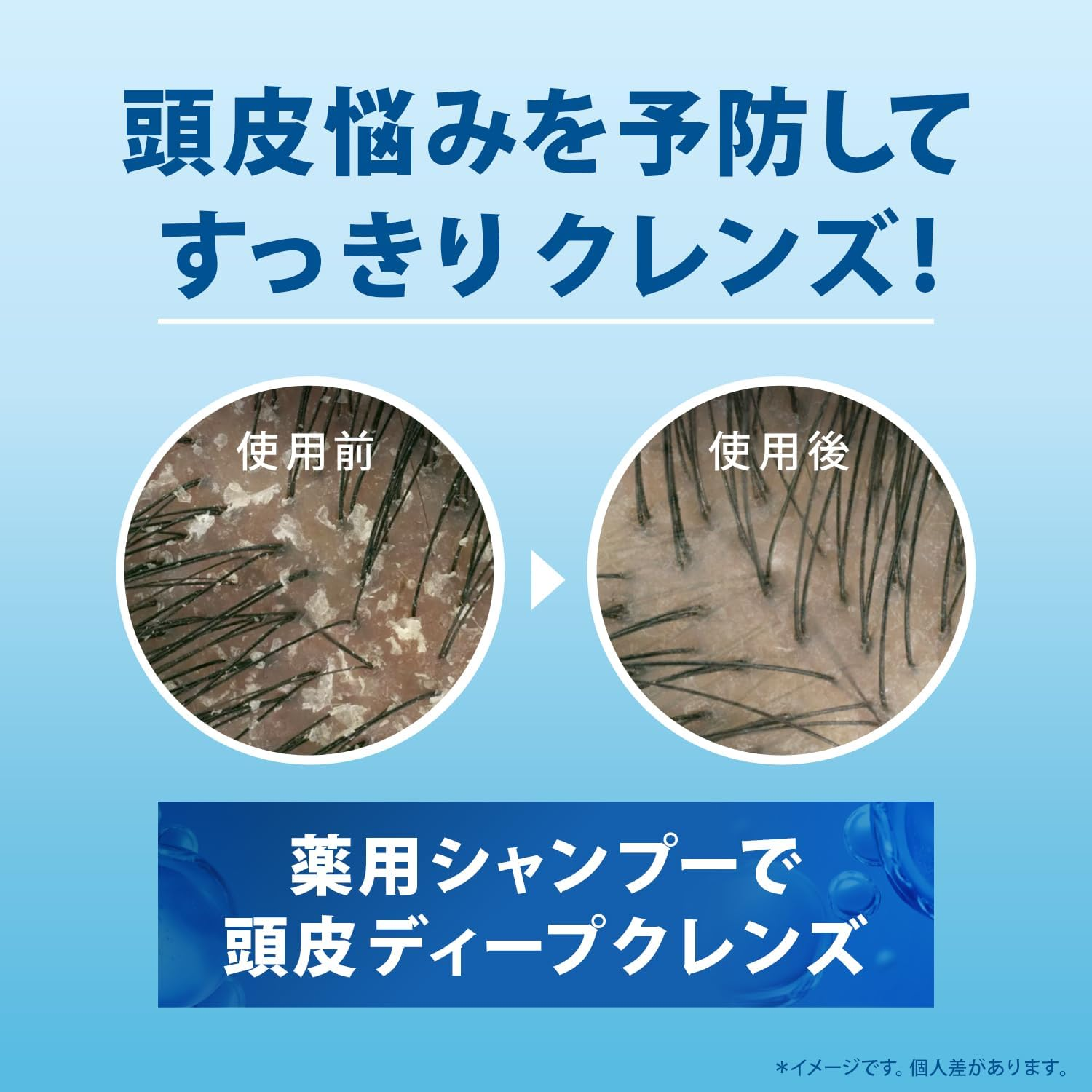 H&S Moisture Shampoo Refill, Extra Large, 6.5 Fl Oz (2.2 L)