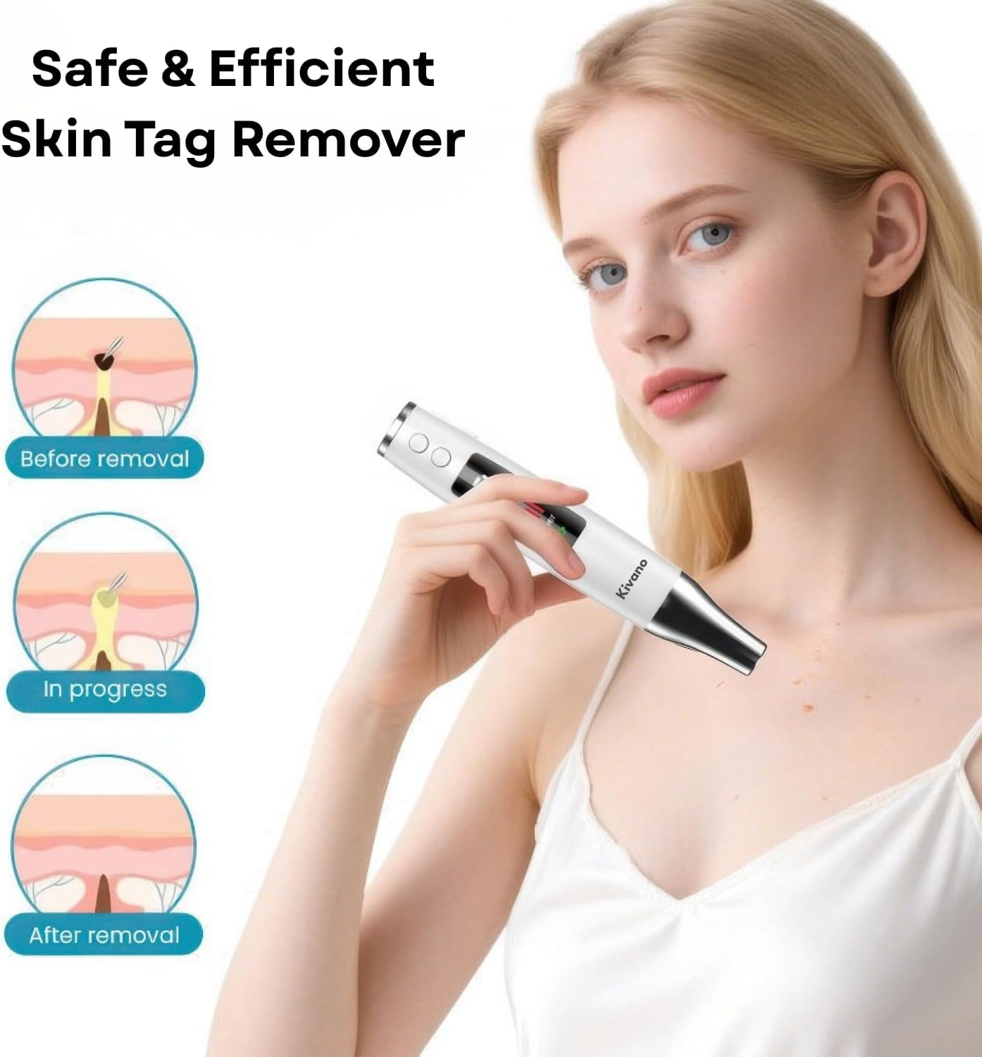 Skin Tag Remover and Wart Remover with Red Light &ndash; Skin Tag Removal Device for Face and Body, 9 Adjustable Strength Levels, Rechargeable Professional Beauty Tool for Safe & Effective Home Use image number 1
