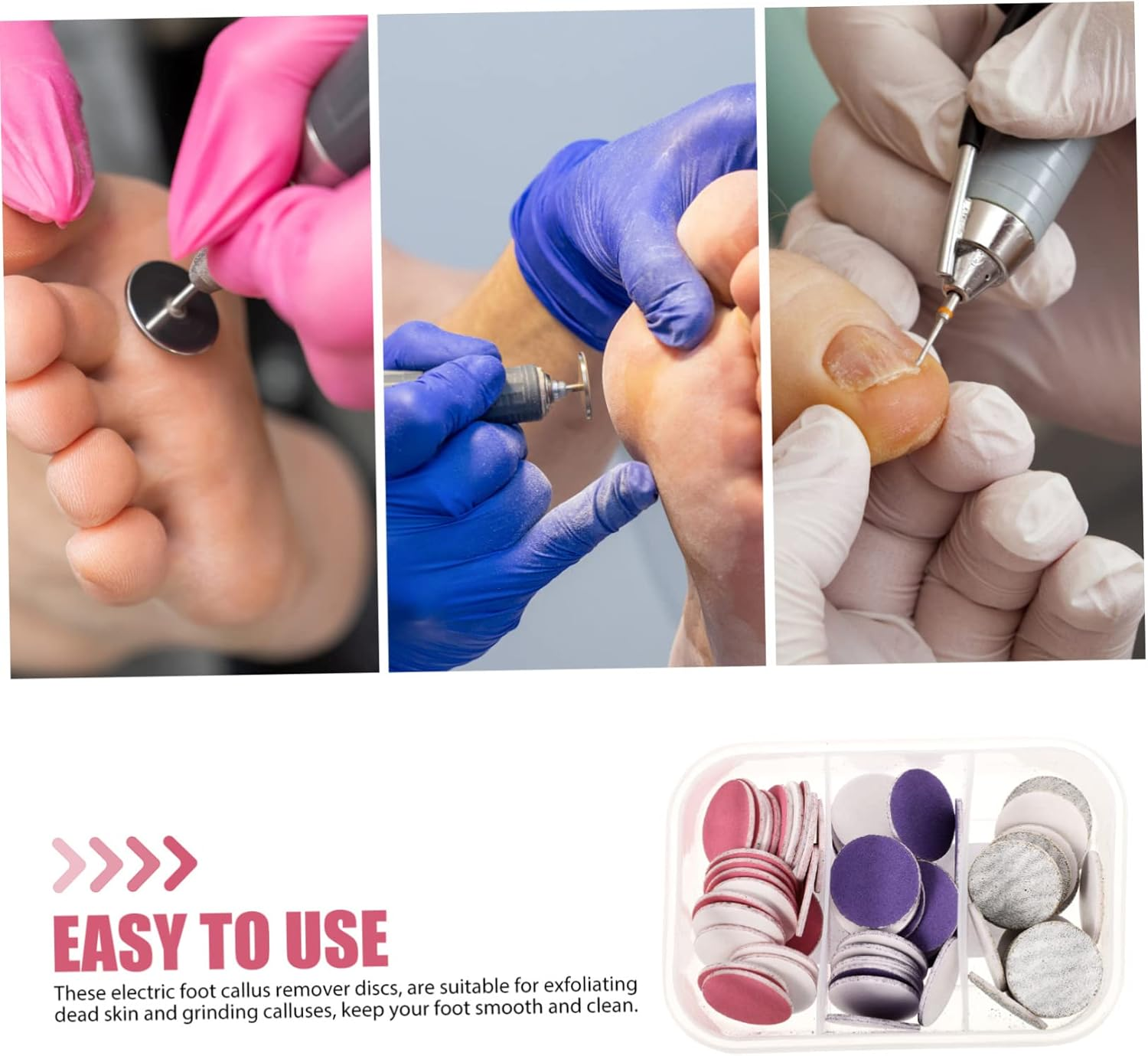 NOLITOY Sanding Discs for Foot File Electric Foot Callus Remover Pads 72Pcs Toe Callus Remover Discs Replaceable Sanding Pads for Professional Use image number 6