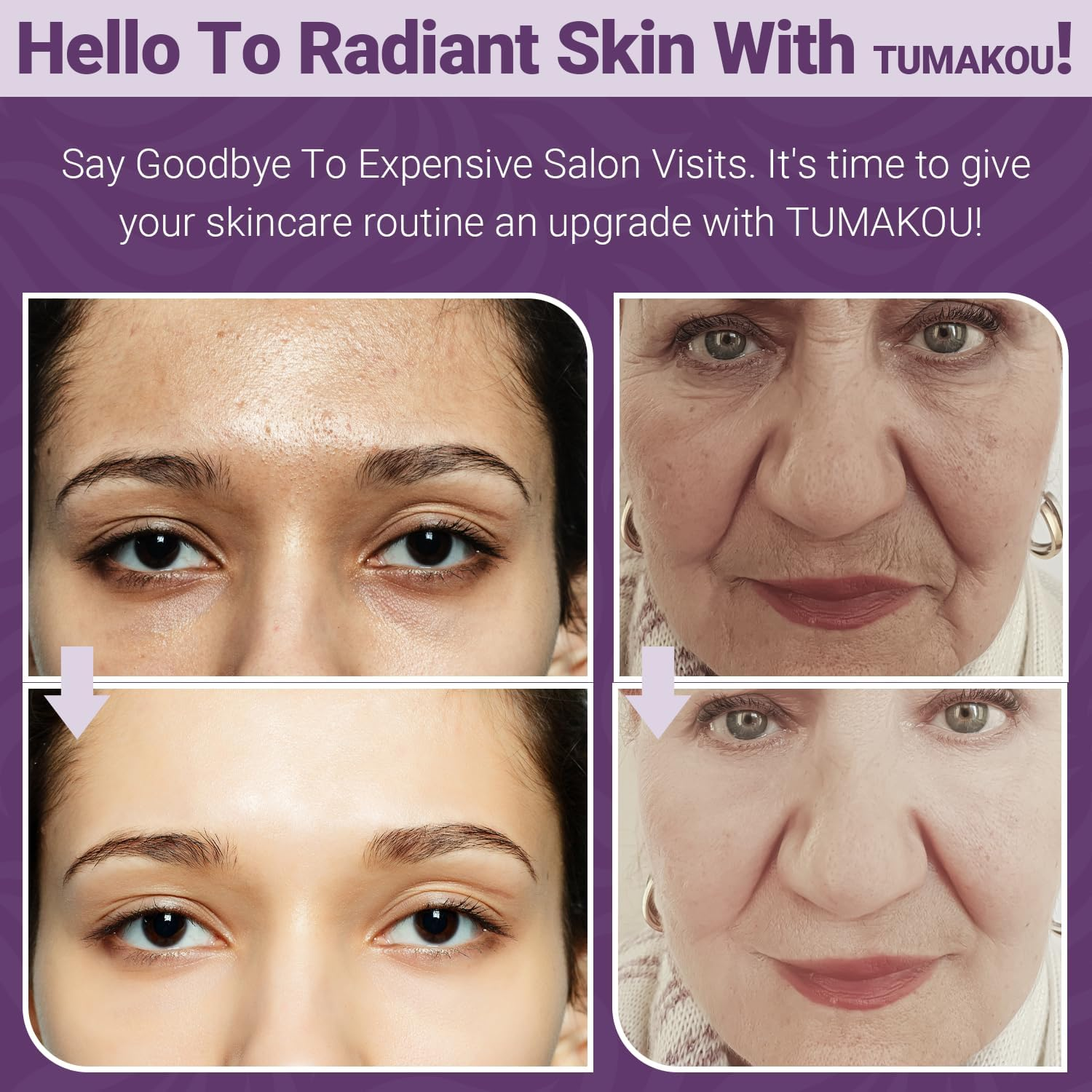 Radio Frequency Device - TUMAKOU 4 in 1 EMS Red Blue Light Therapy Wand for Face at Home - Microcurrent Facial Device - RF Radiofrequency Skin Neck Facial Machine image number 5