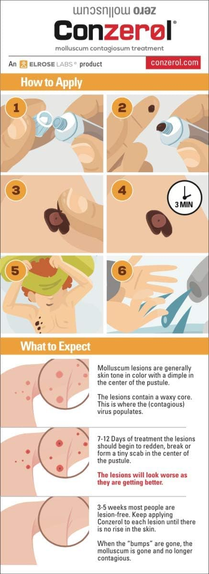 Molluscum Treatment - Kids & Adults by Conzerol image number 2