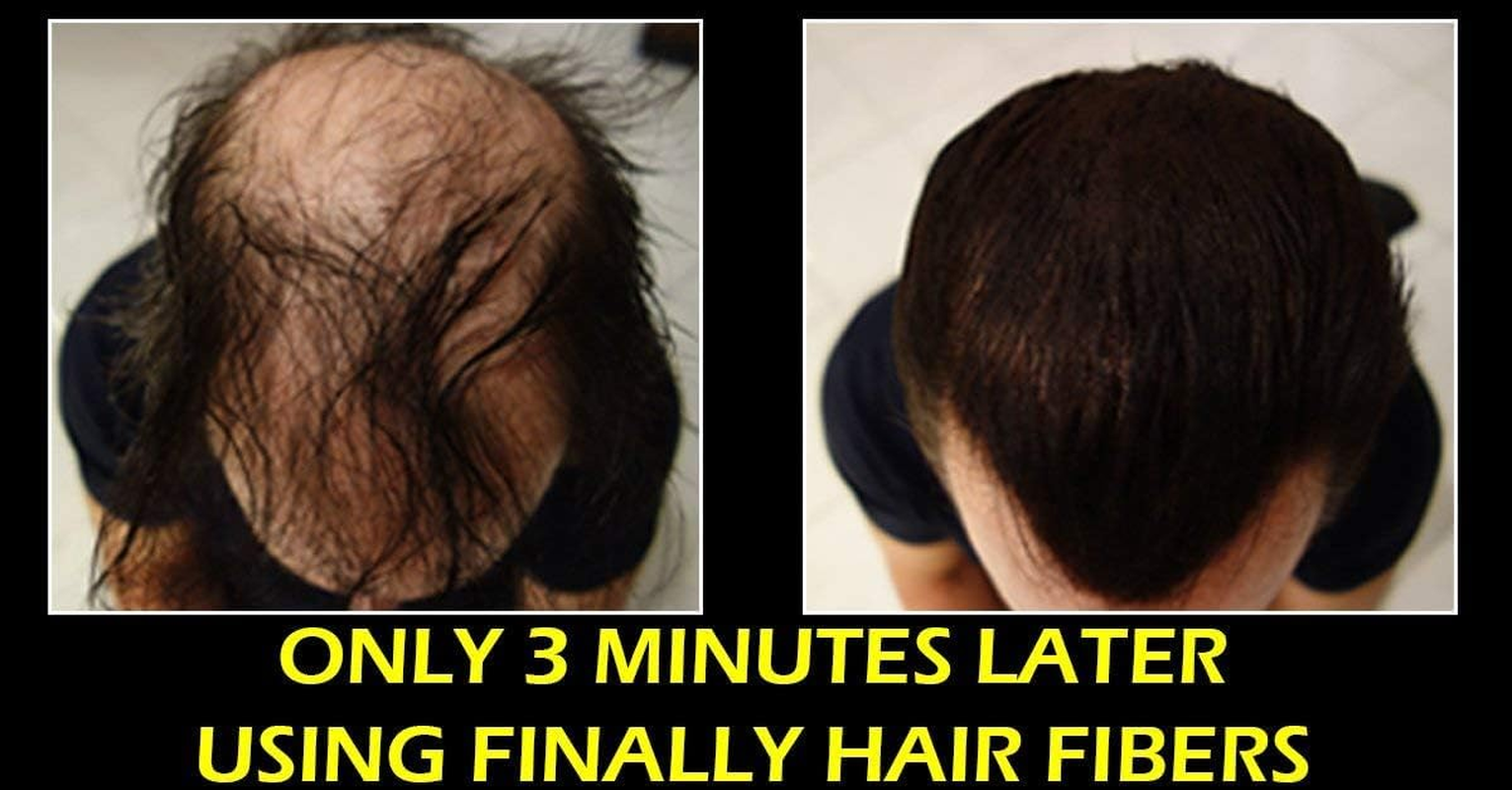 Finally Hair Fiber Lock Strong Holding Spray. Compatible/Replacement for Toppik, Xfusion, Febron, Bosley, Nanogen image number 1