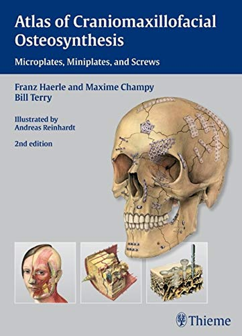 Atlas of Craniomaxillofacial Osteosynthesis: Microplates, Miniplates,And Screws