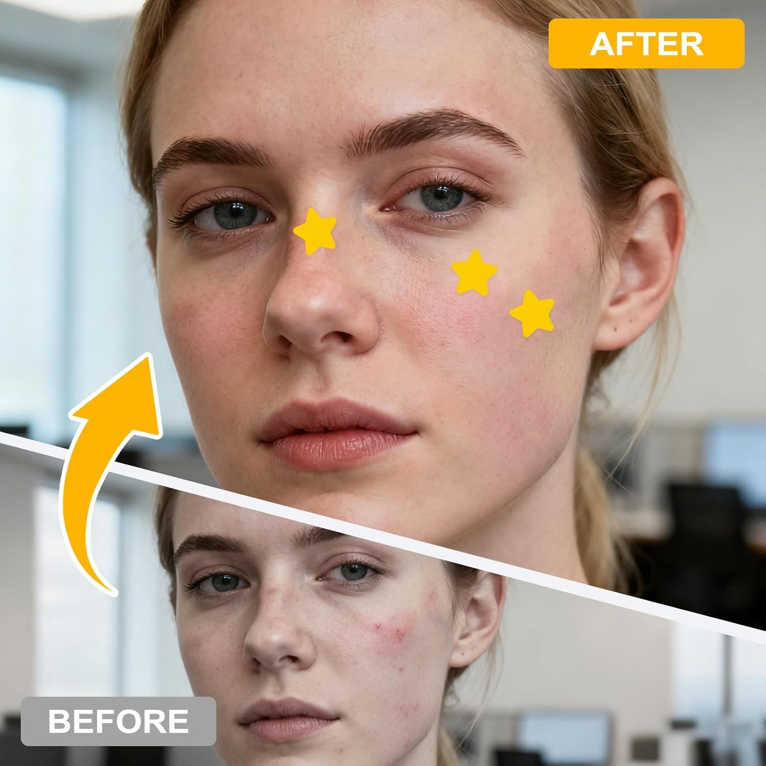 Starface Pimple Patches,64Pcs Hydrocolloid Pimple Patches,Star Spot Patches for Face and Skin Care image number 2