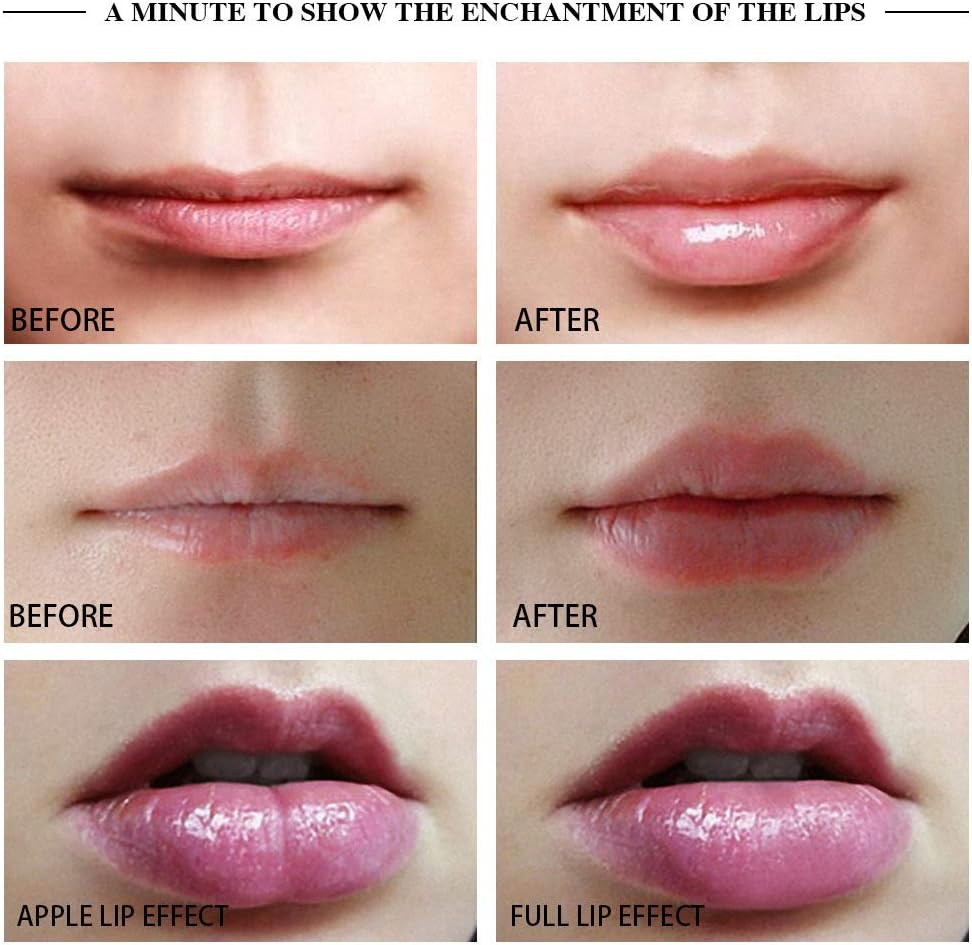 Electric Quick Lip Plumper Device Tool Soft Silicone Beauty Natural Sexy Mouth Lip Enlargement Plumping Enhancement Silica Gel Women Girls Apple Lip & Full Lip image number 6