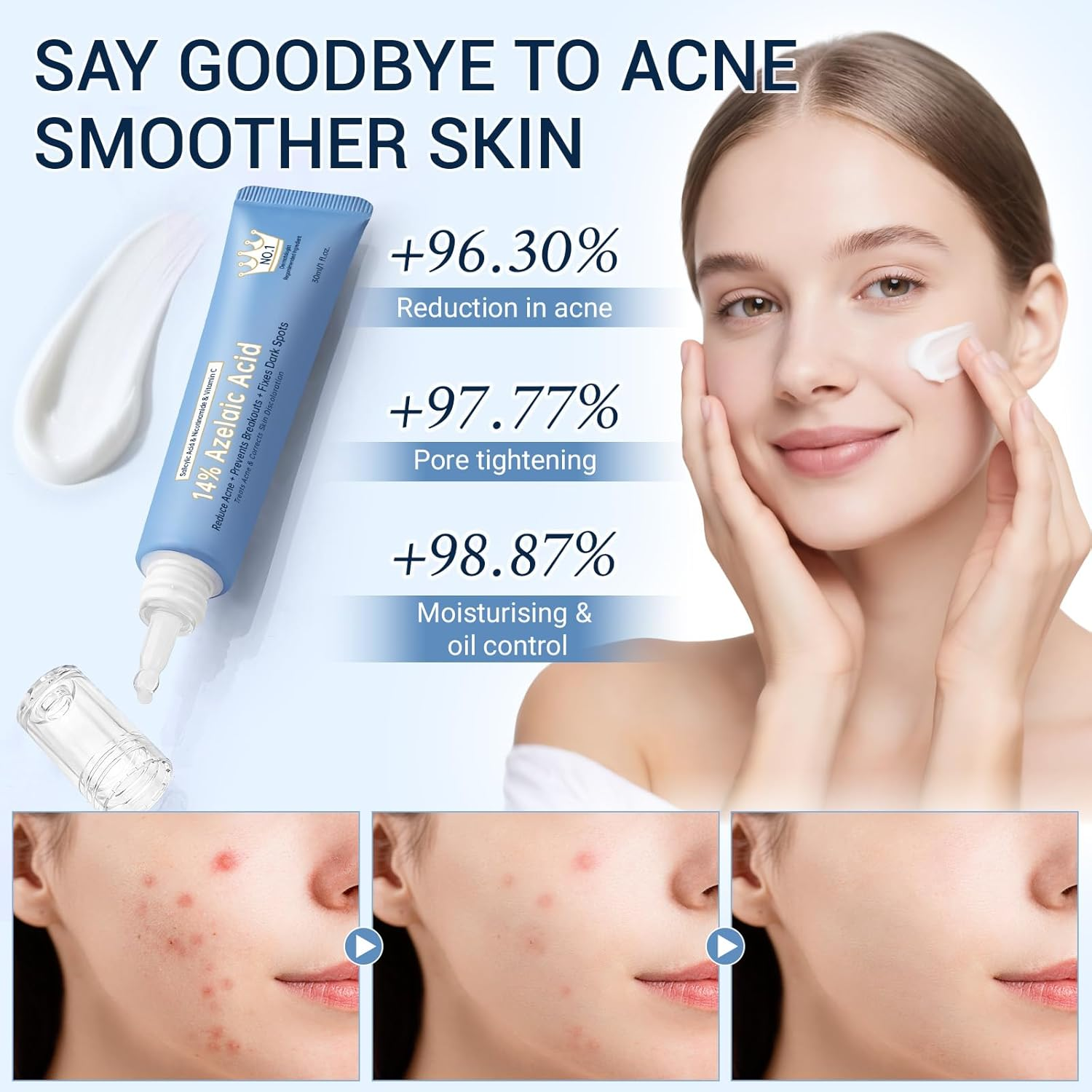 14% Azelaic Acid Cream - Azelaic Acid Serum with Hyaluronic Acid, Niacinamide & Squalane - Pore Refining & Oil Control - Face Moisturizer for All Skin Types, 30ML image number 6