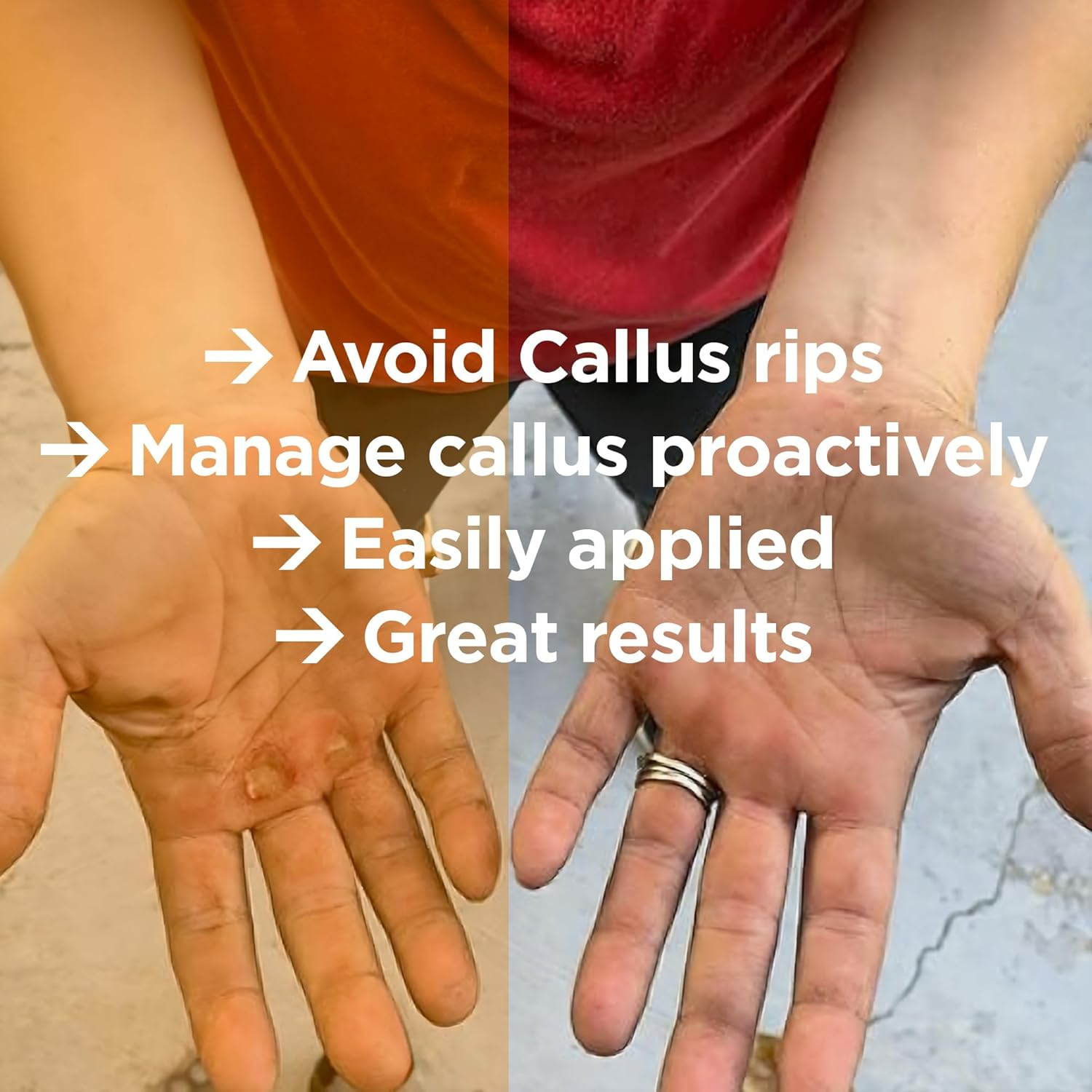 Callus Performance - the Ultimate Callus Remover for Crossfit Athletes and High Friction Hand Use. L Remove Unwanted Calluses I Prevents Ripping and Tearing of Hands I image number 6