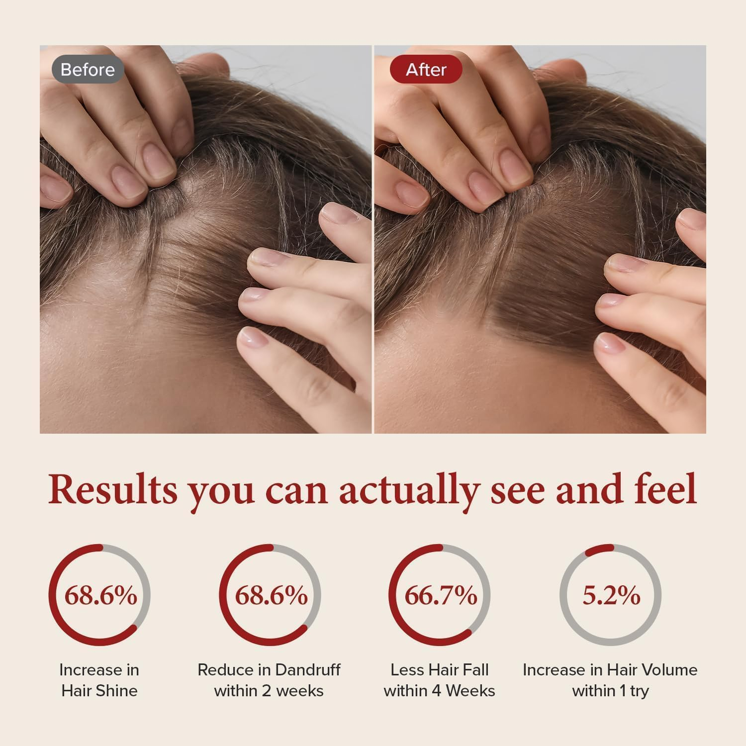 KUNDAL Natural Caffeine Scalp Shampoo [Cherry Blossom] Korean Hair Care, K-Beauty, Deep Cleansing, Scalp Care, for Thinning Hair, Helps Thickening, Scalp Care & Hair Strengthening, Natural Coffee Beans, Hydration, All Hair Types, for Men and Women 500Ml (Pack of 2) image number 1