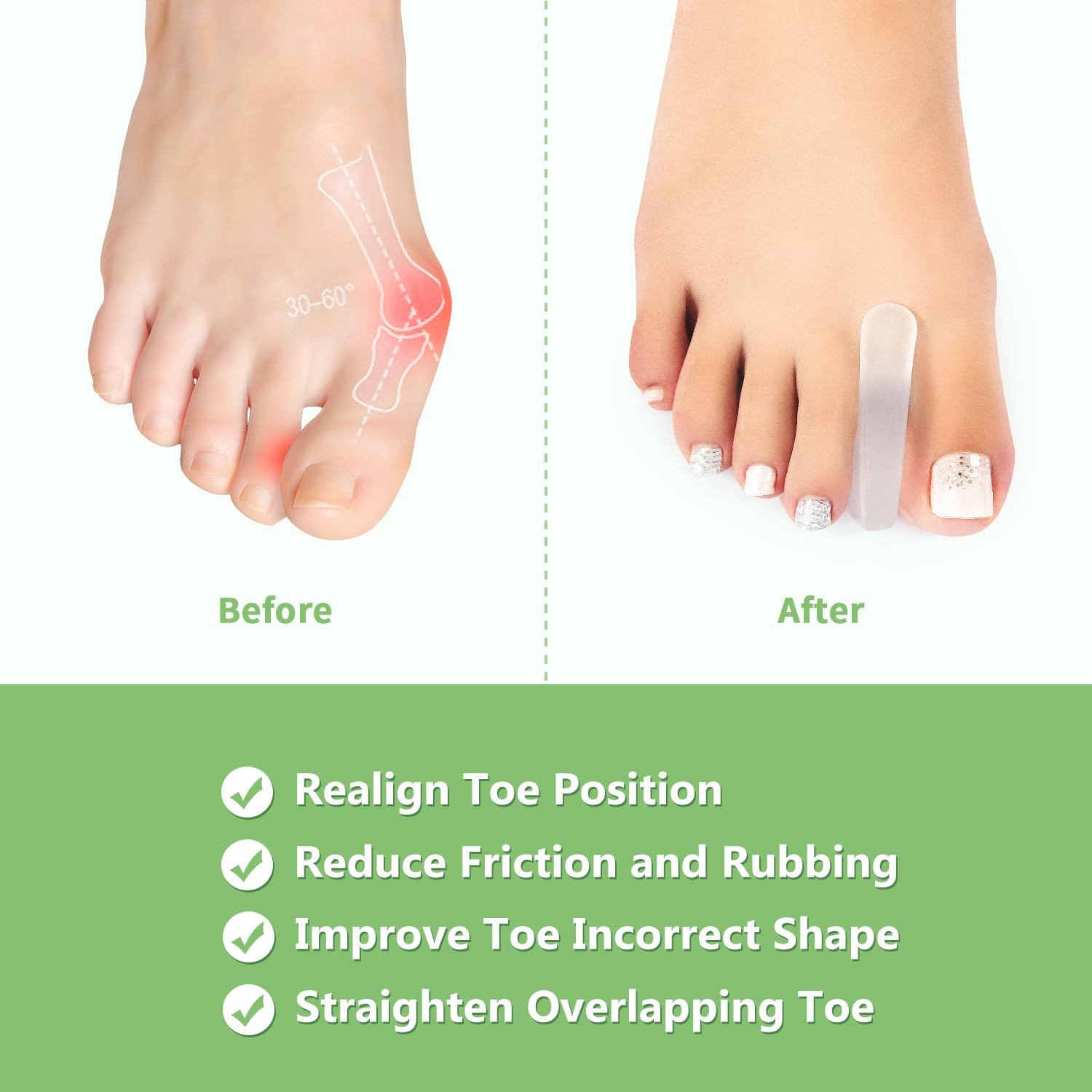 Niupiour Silicone Big Toe Separator for Bunion, 10 Pack- Large Toe Spacer for Women and Men, Flared Design Toe Straightener for Aligning Toes and Correcting Toe, Prevent Blisters, Calluses and Corns image number 5