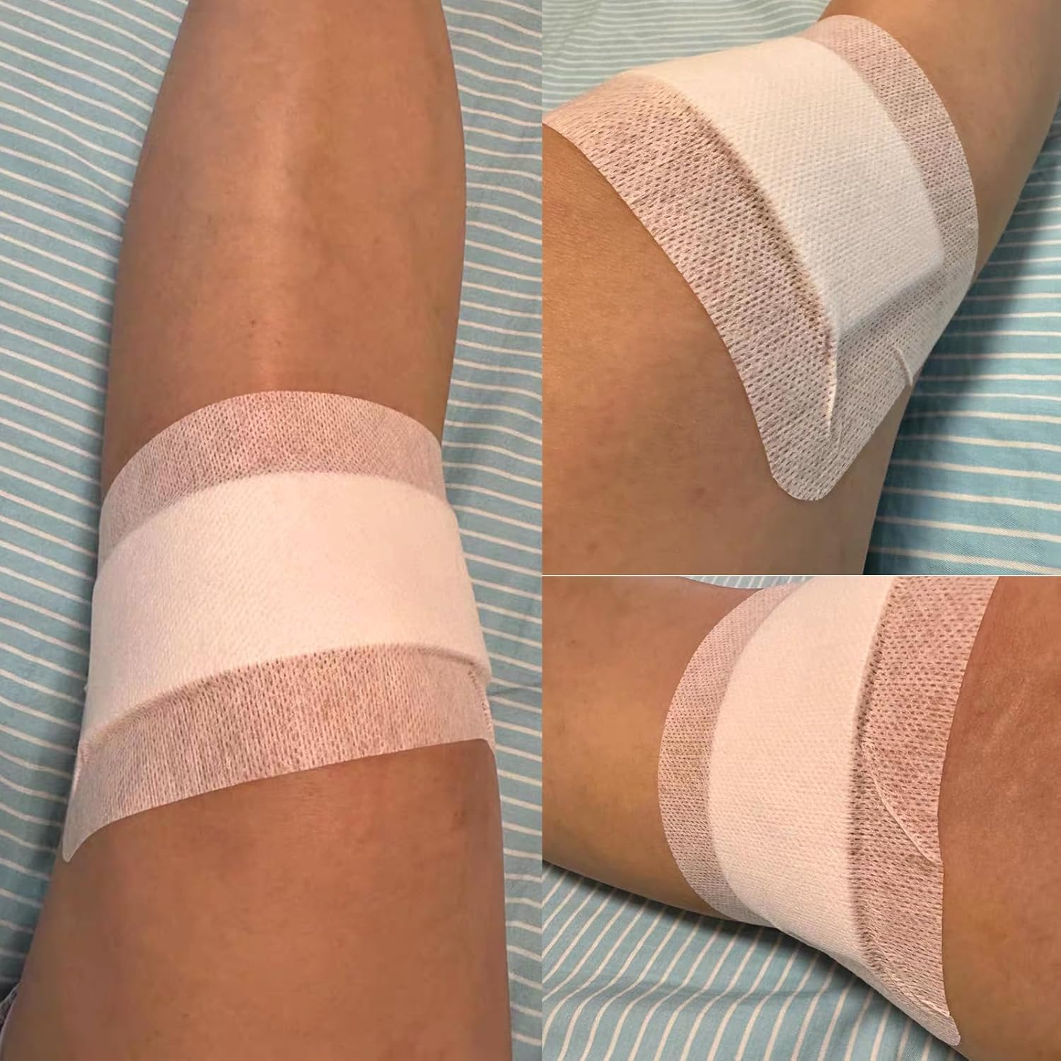 Adhesive Wound Dressings Pads Medium,Absorbent Breathable Dressings Patches Bandage,Individually Wrapped for Wounds First Aid(10X15Cm, 10PCS) - 10X25Cm-10Pcs image number 2